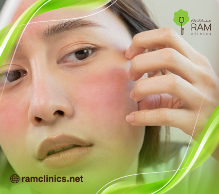 ما هو الزهم