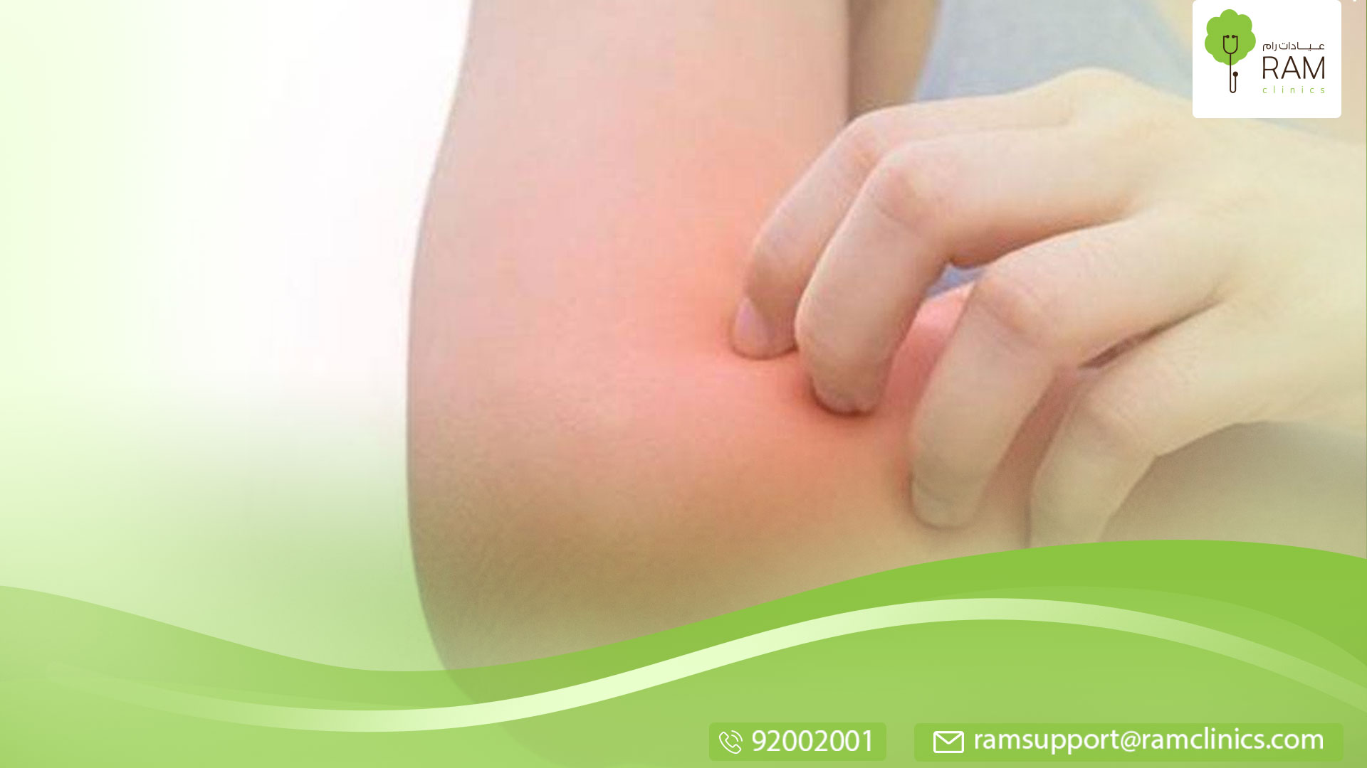 علاج الحكة في حالات الطفح الجلدي