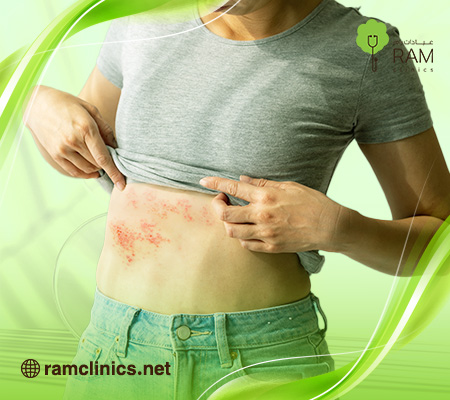 اعراض طفح جلدي تحسسي