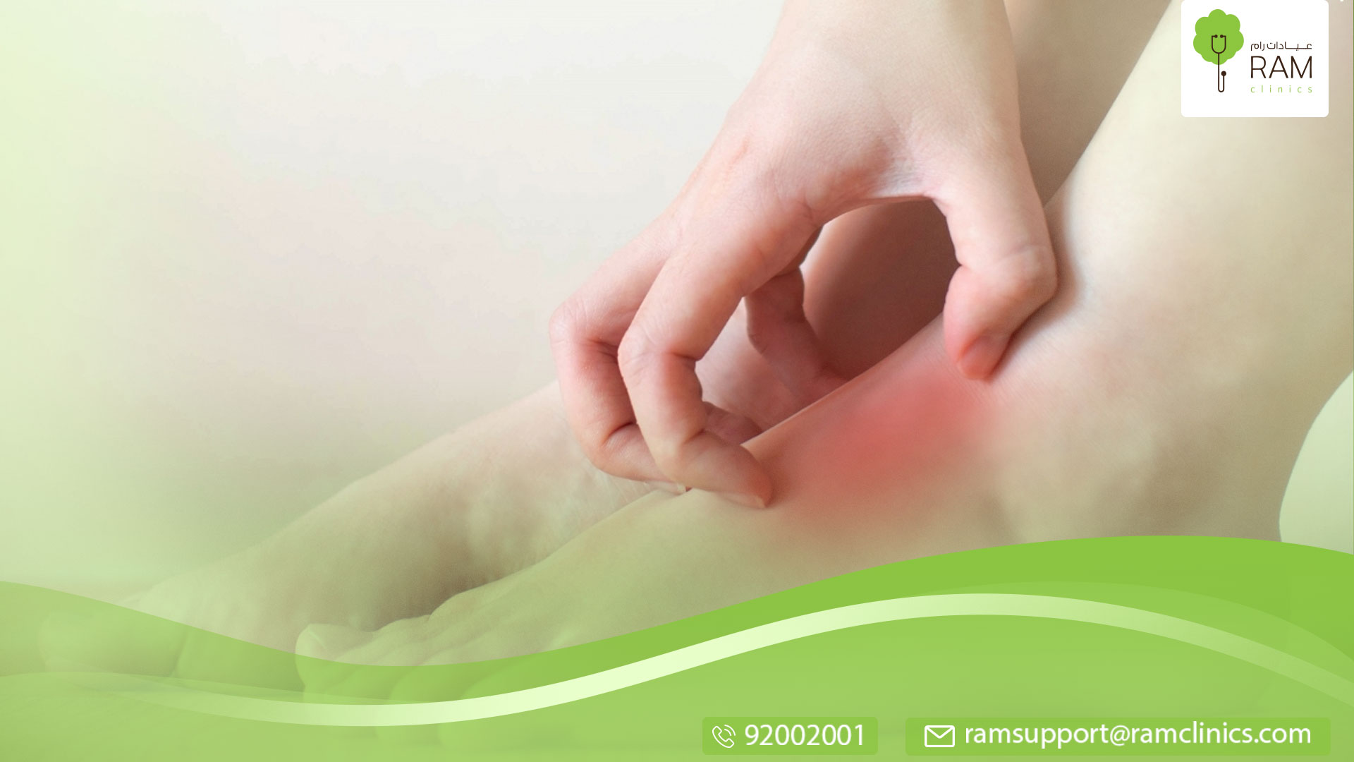 حكة  القدمين