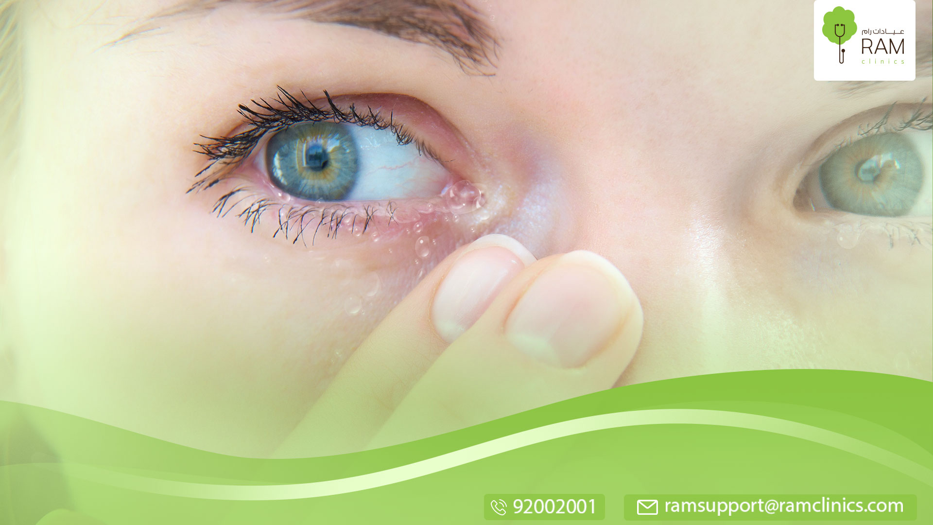 مشاكل العيون وعلاجها