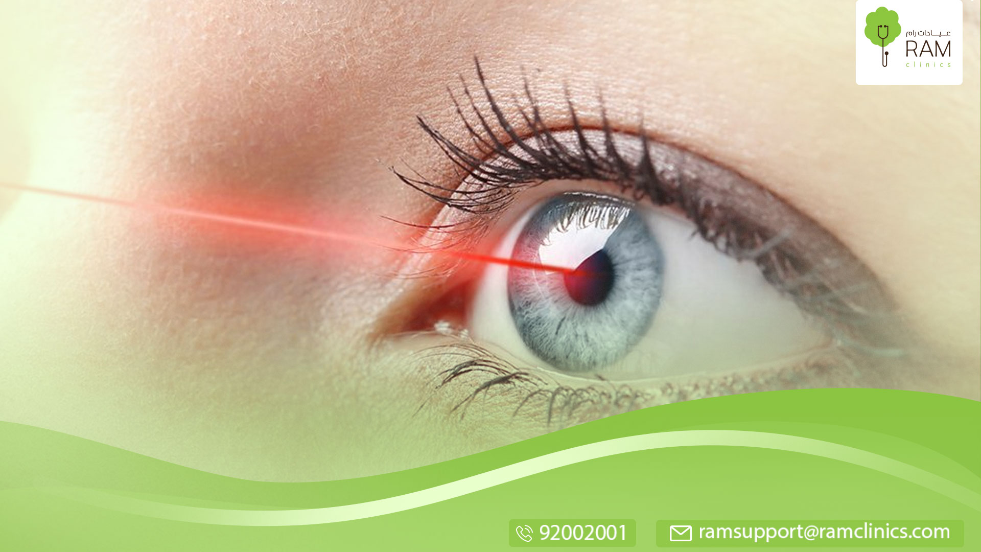 جراحة العين بالليزر