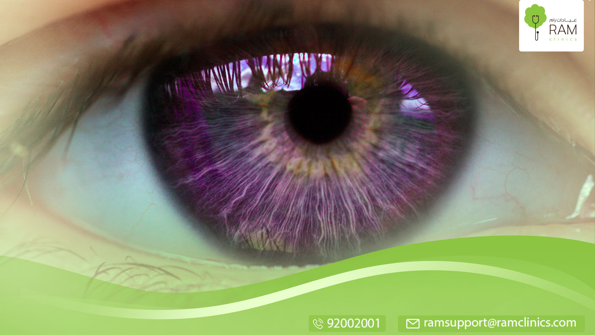 ما هي متلازمة الإسكندرية