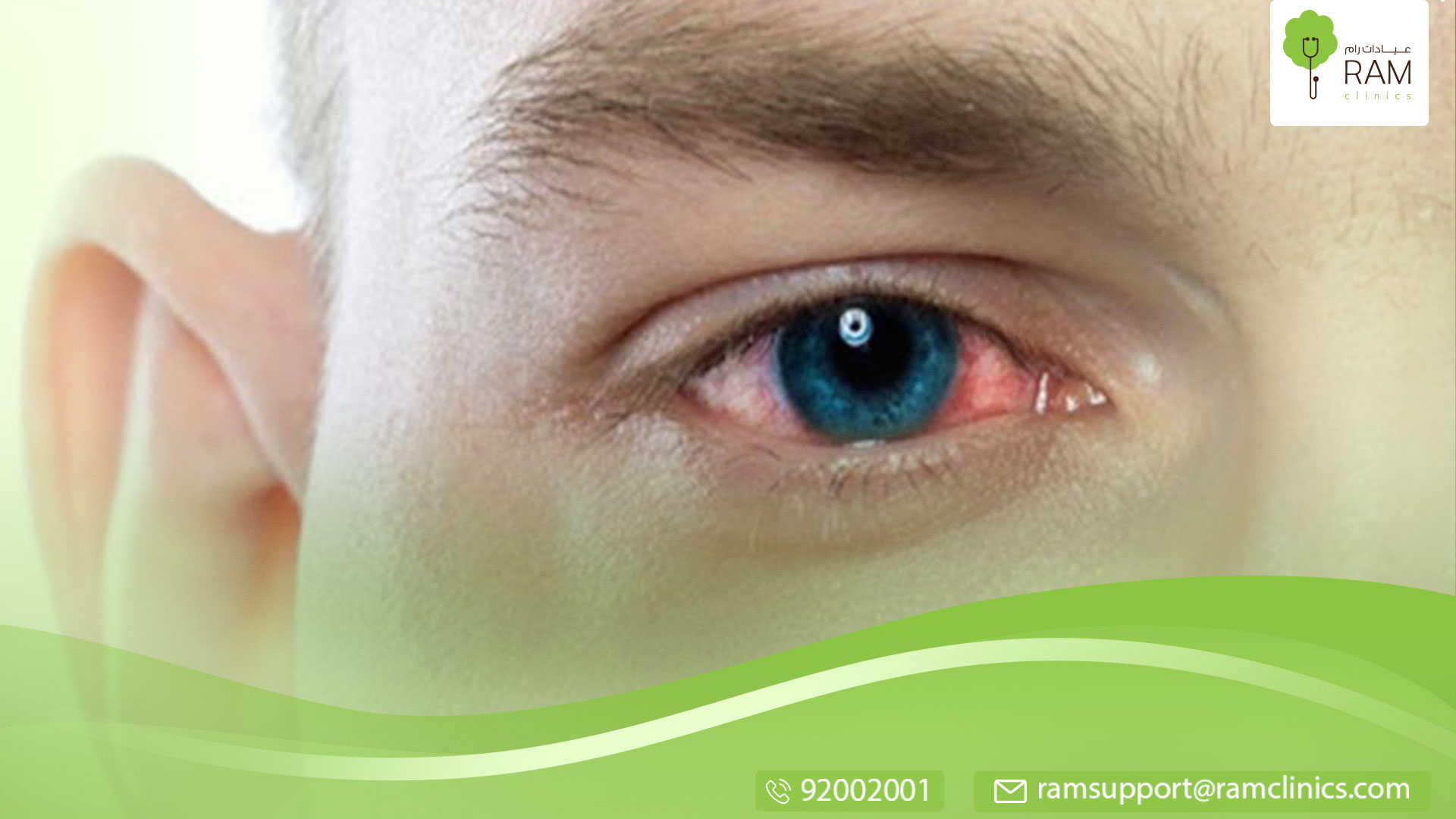 اسباب احمرار العين عند الرضع