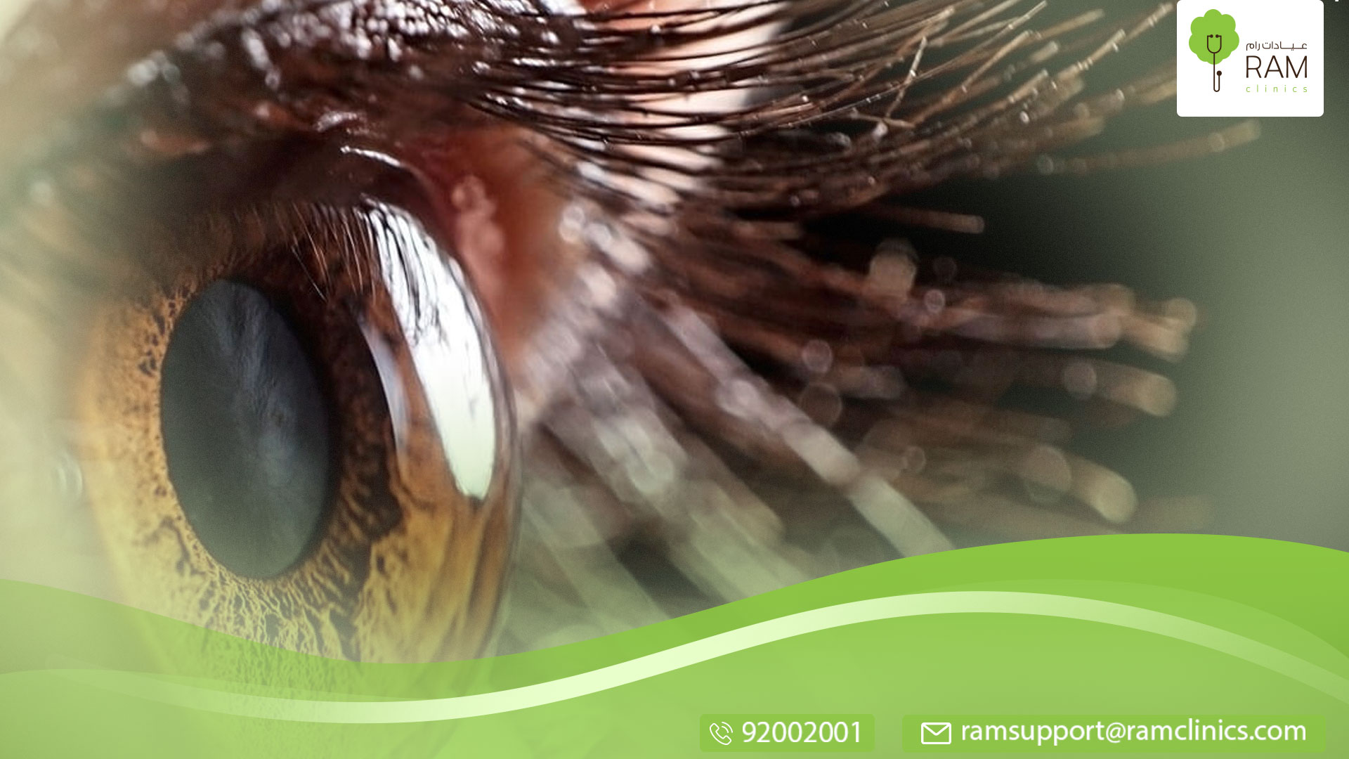 أمراض بؤبؤ العين