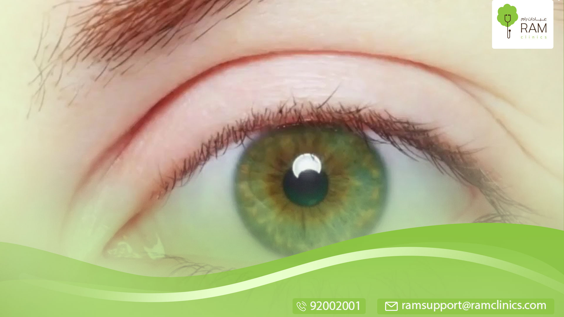 هيتروكروميا