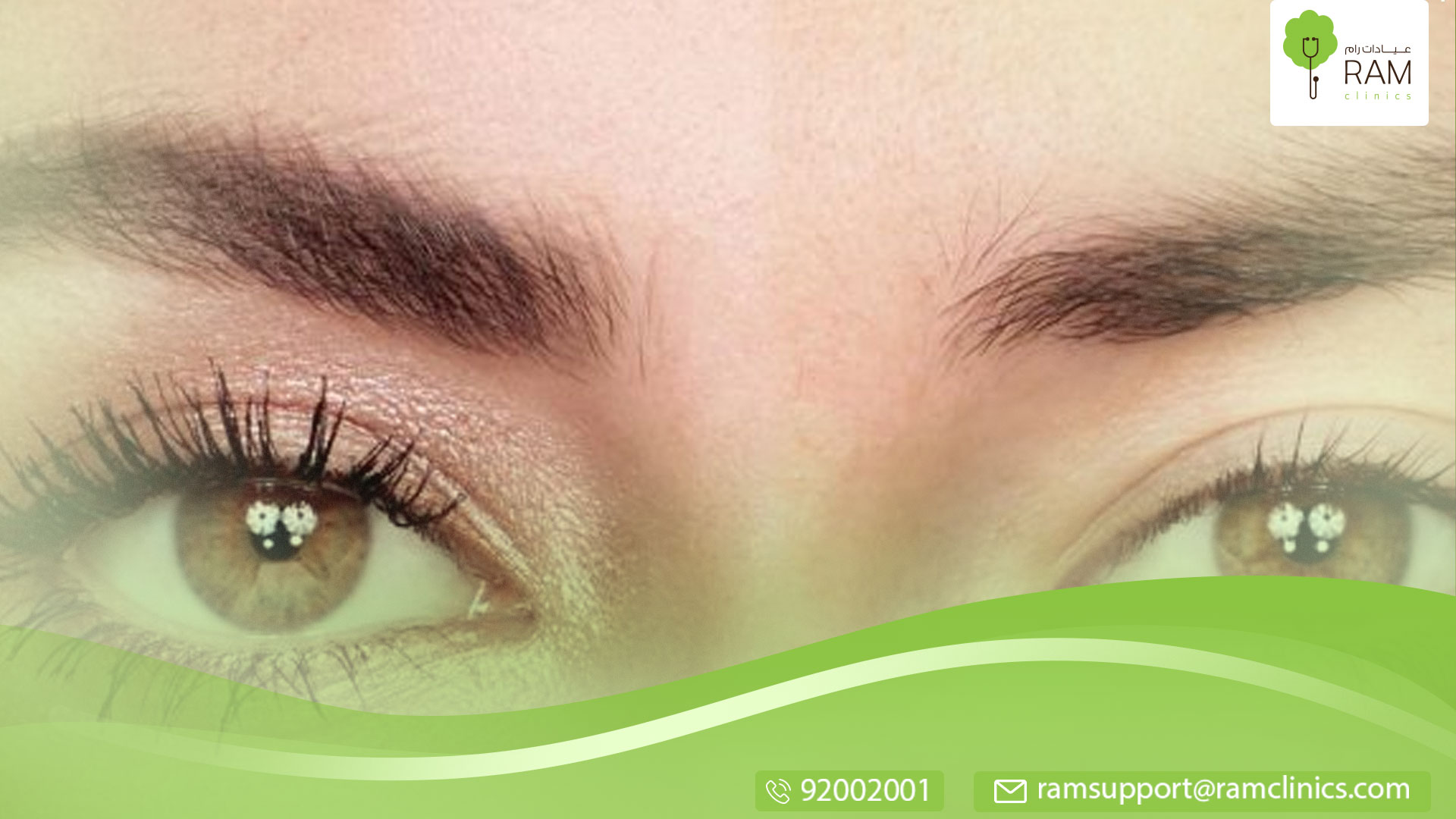 مرض متلازمة ادي