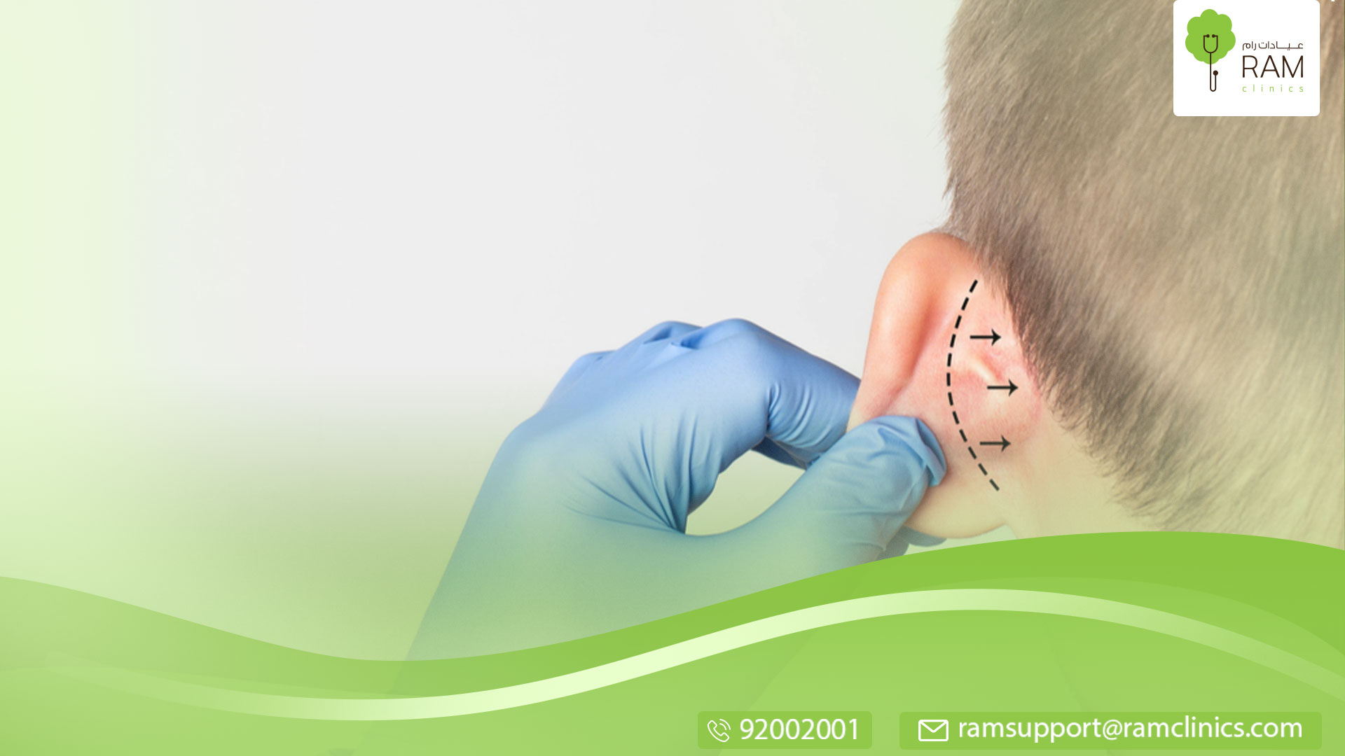 عملية تجميل الأذن