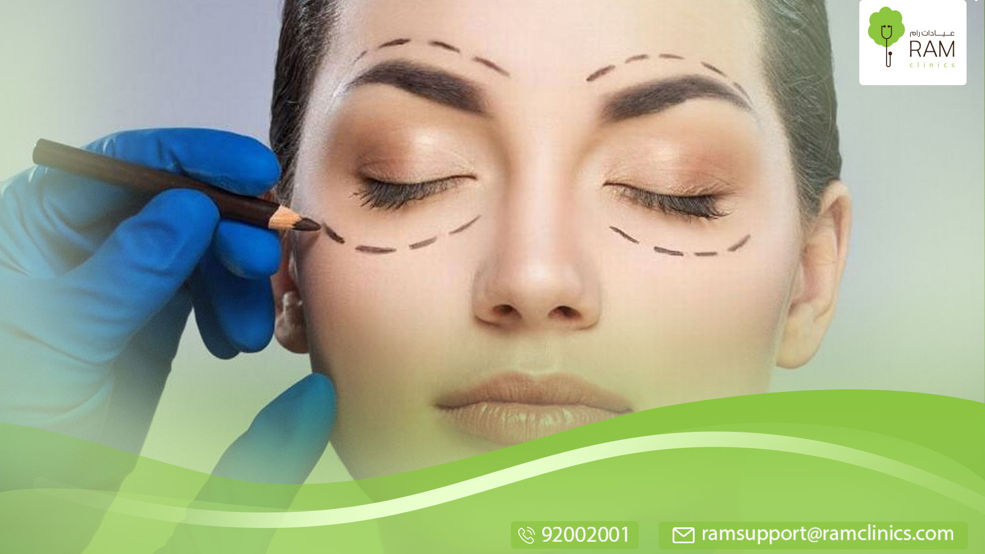 جراحة رفع الحاجبين التجميلية