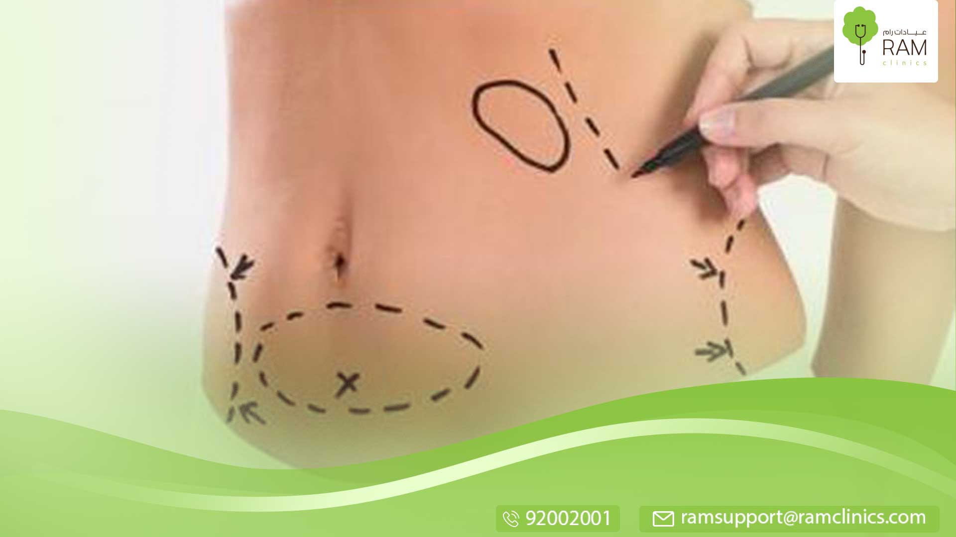 مخاطر عملية شفط الدهون