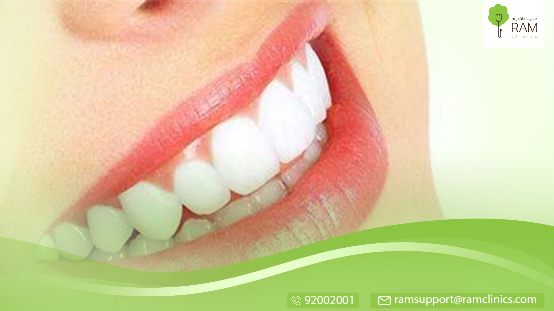 علاج بروز الأسنان