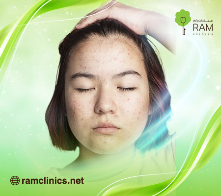 طرق علاج الحبوب الحمراء في الجسم