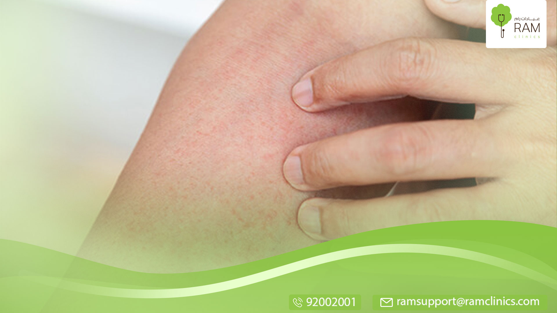 أسباب ظهور نقط حمراء على الذراع