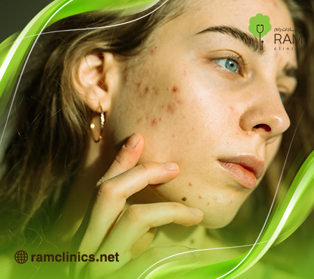 ظهور-حبوب-صغيرة-في-الجسم