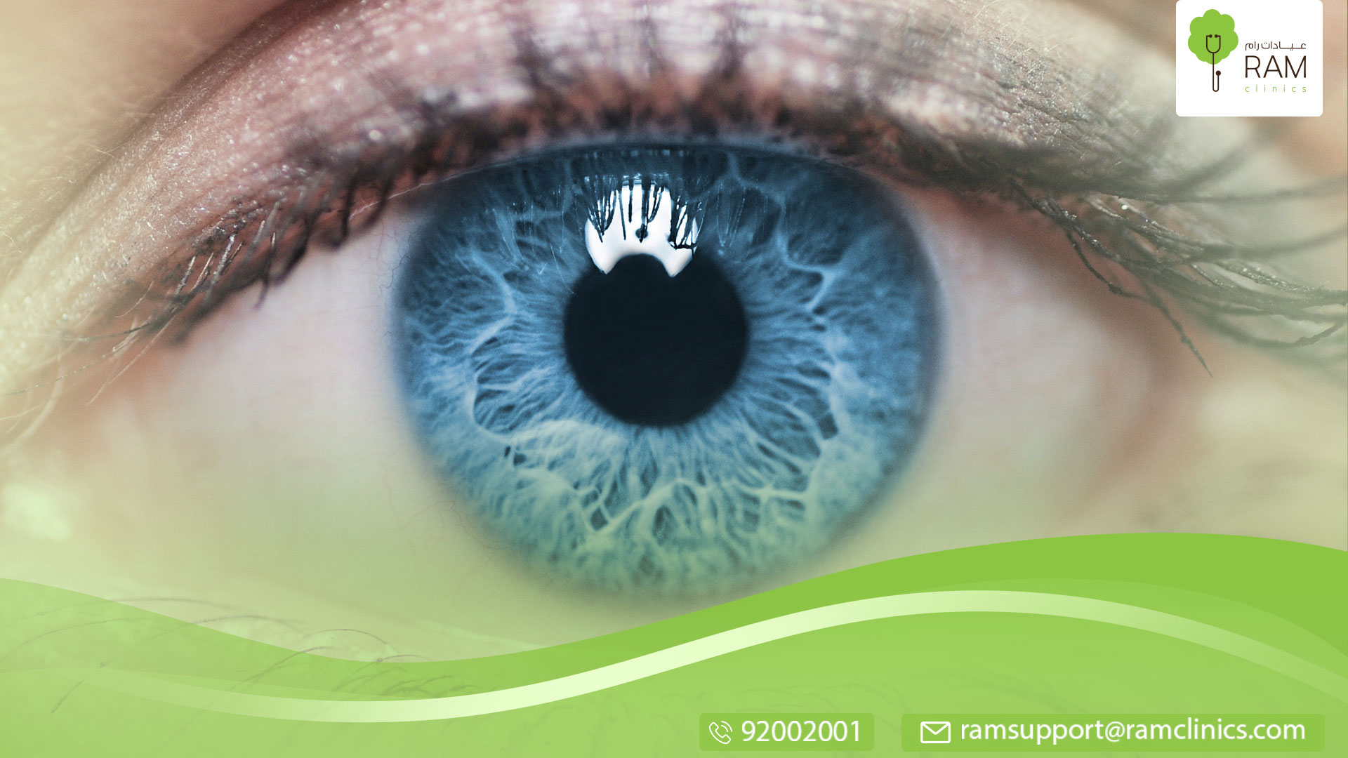 توسيع حدقة العين