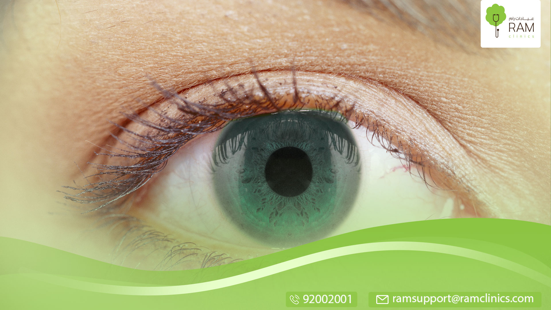 تَمَخْرُطُ القَرْنِيَّة