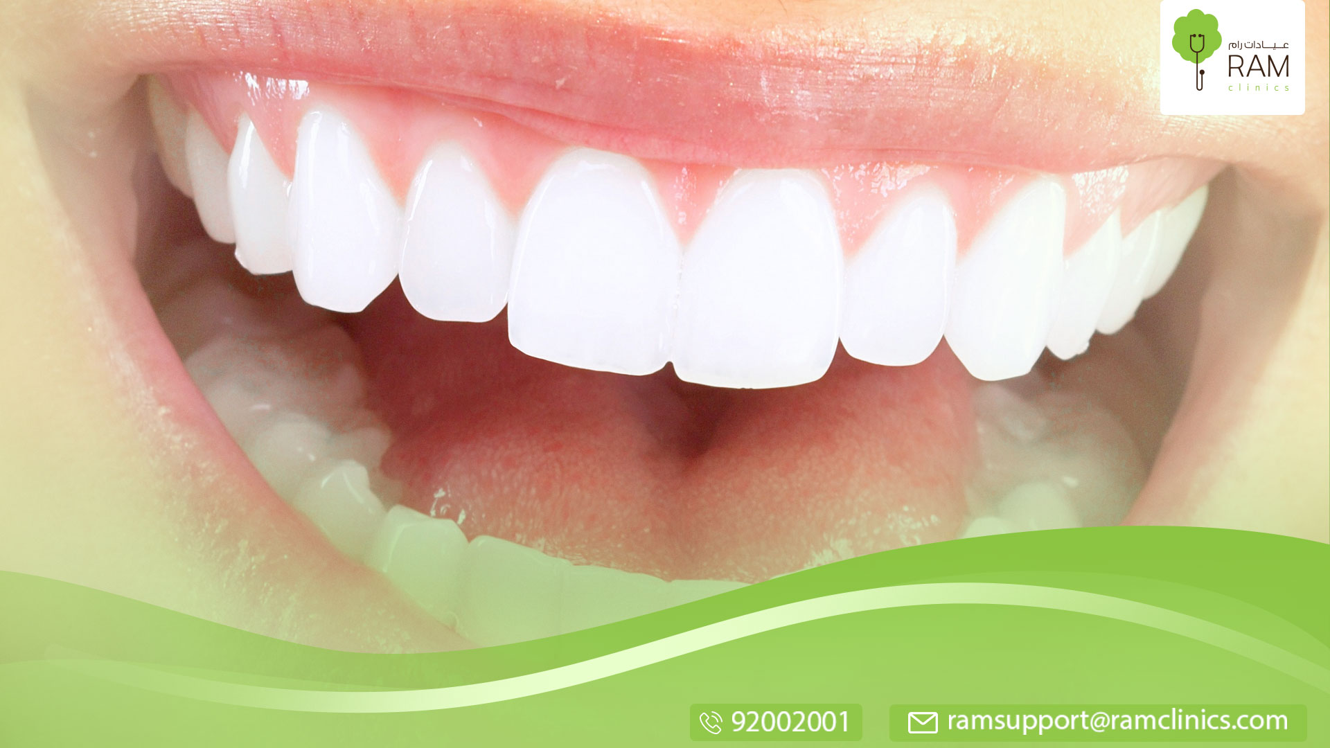 طرق تبيض الأسنان بالمنزل