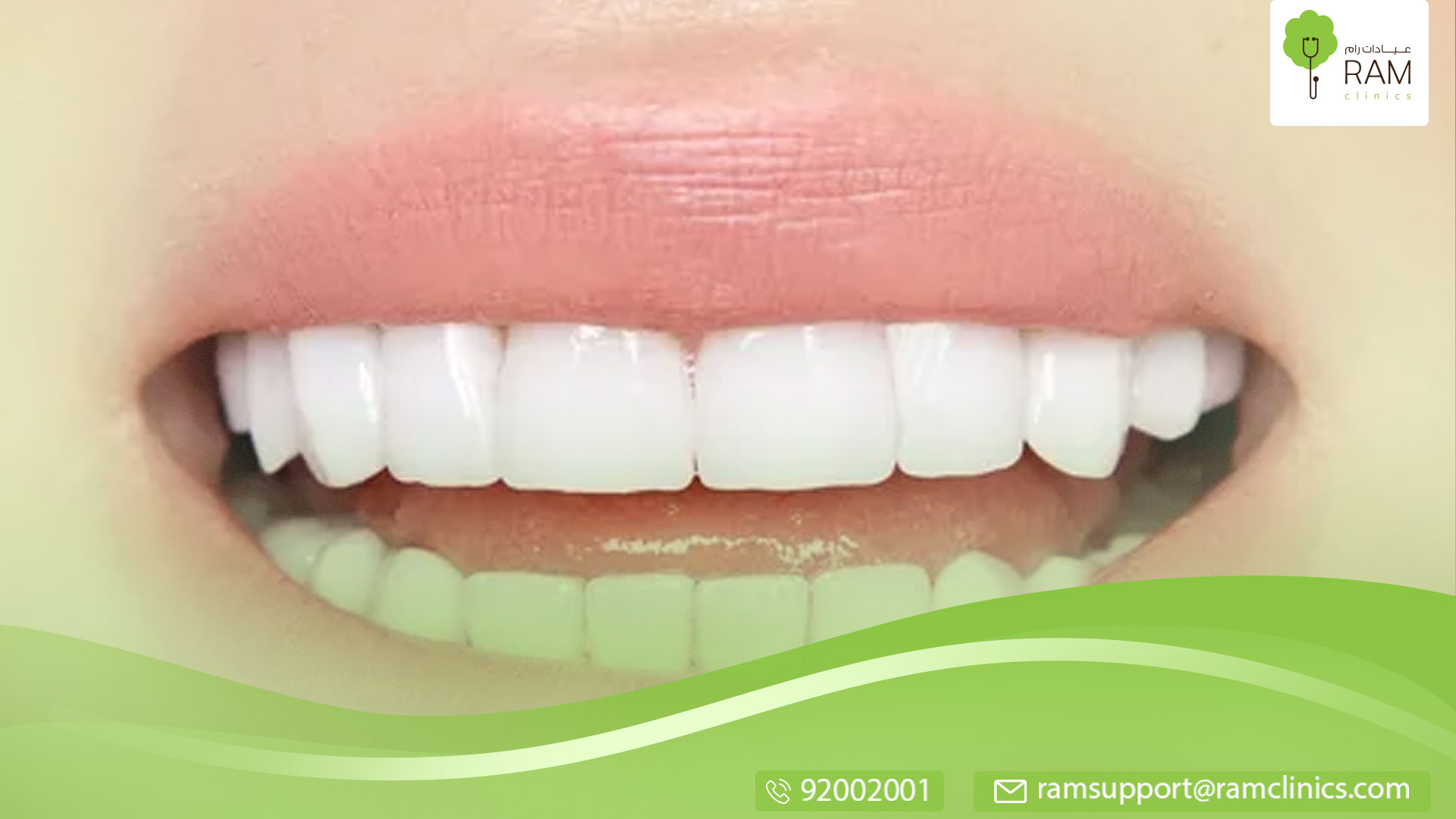 ضيق الفك العلوي معلومات تهمك