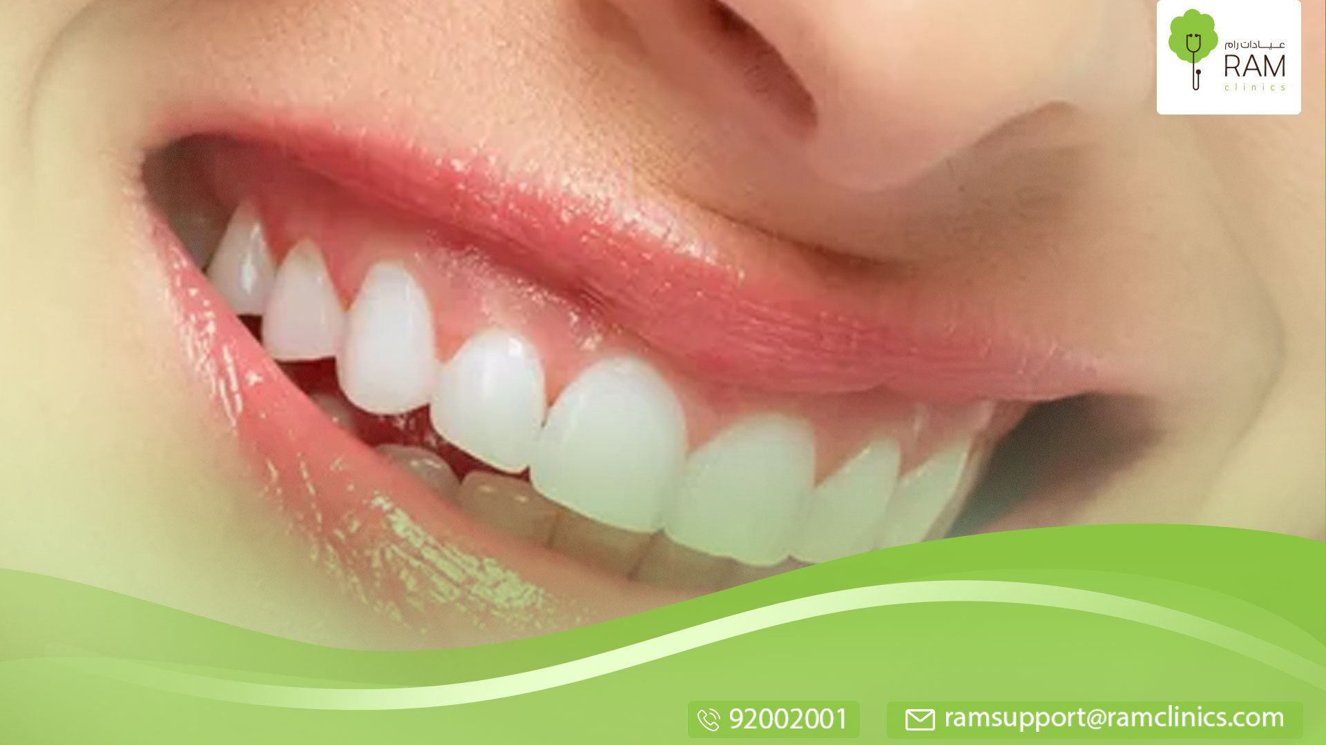 معلومات عن الحشوة الدائمة للأسنان