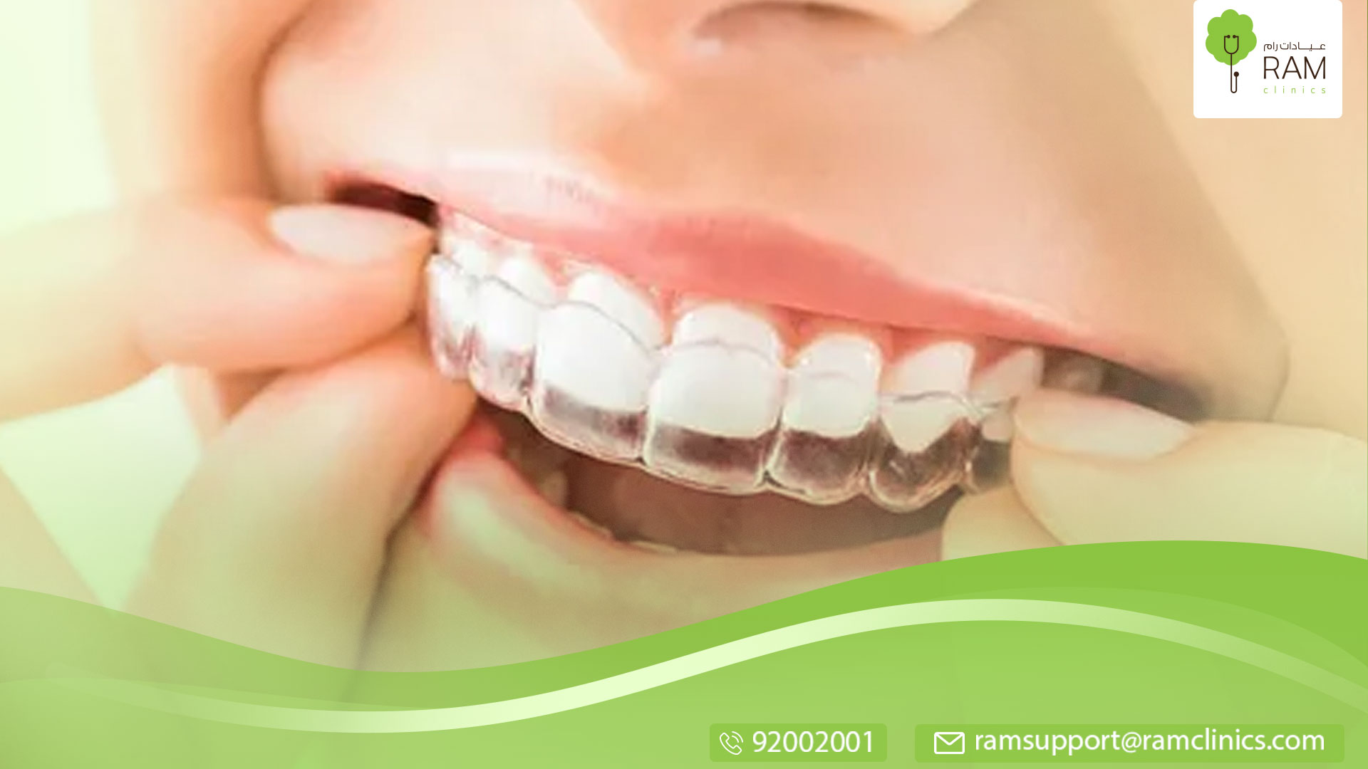 تعرف علي التقويم الشفاف