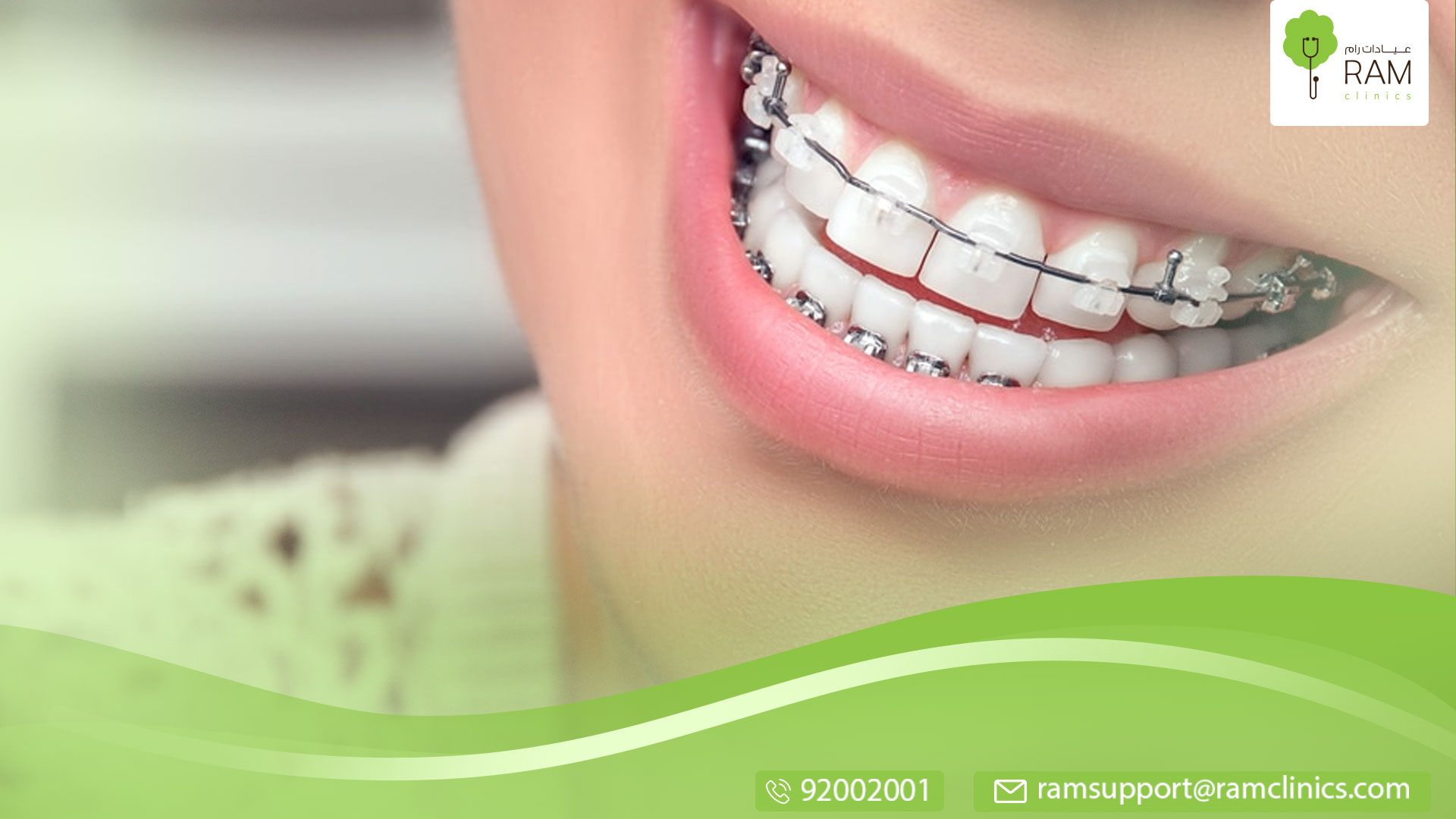 تعرف علي التقويم الشفاف