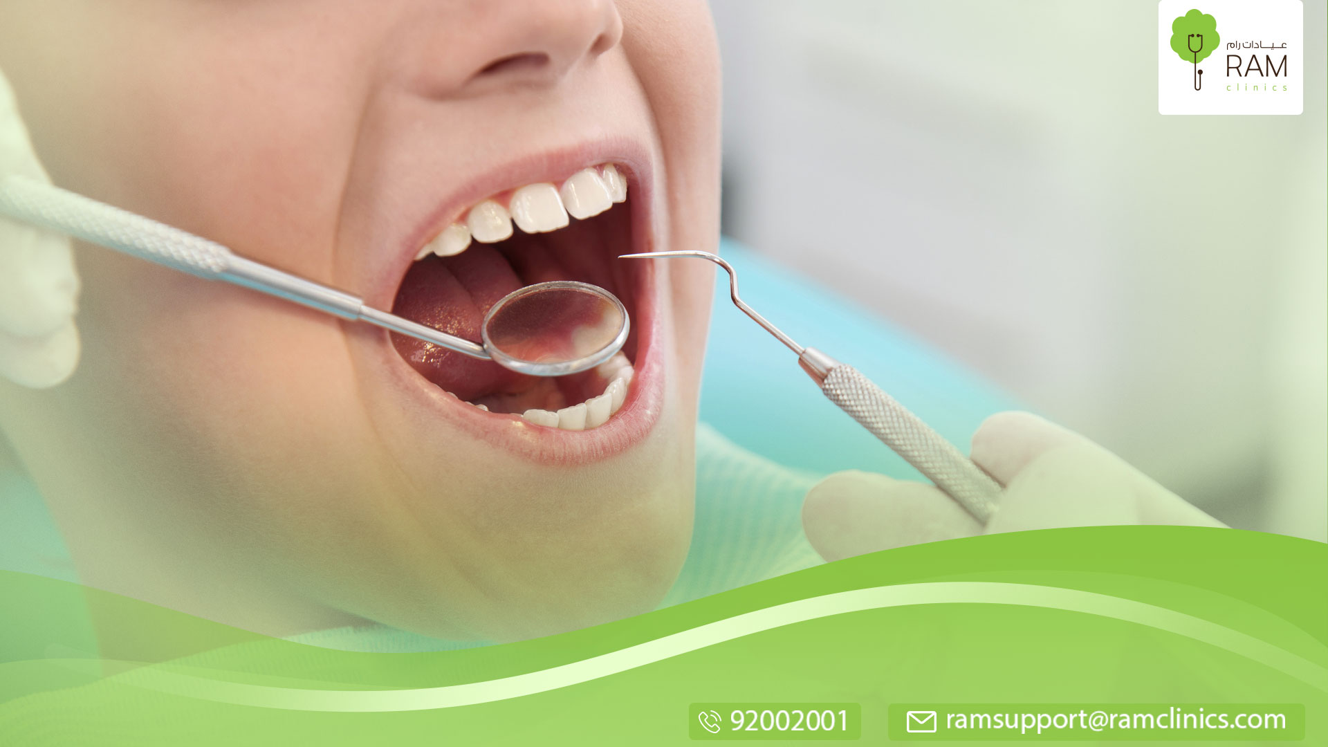 عصب الأسنان