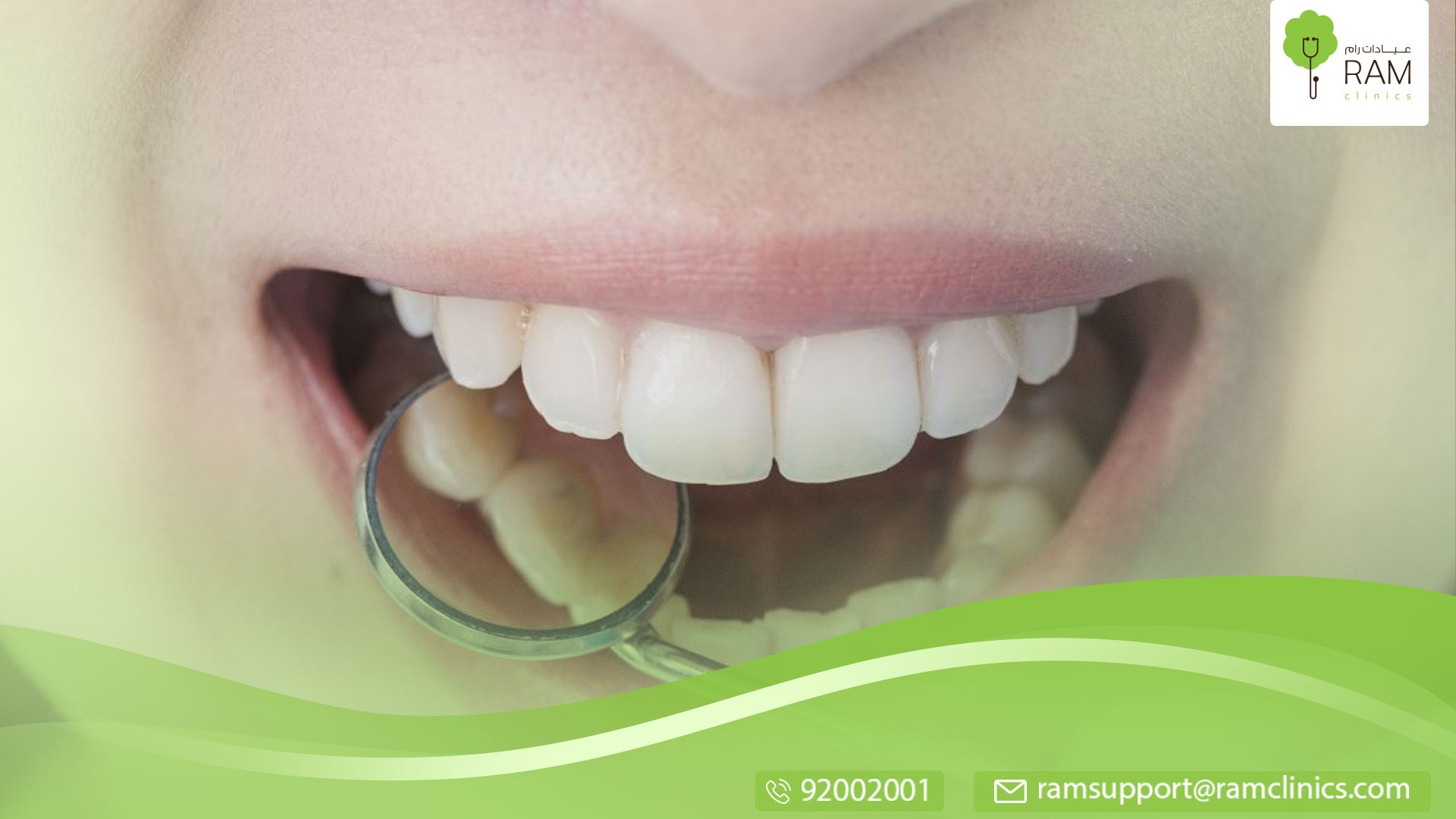 معلومات عن خراج الأسنان