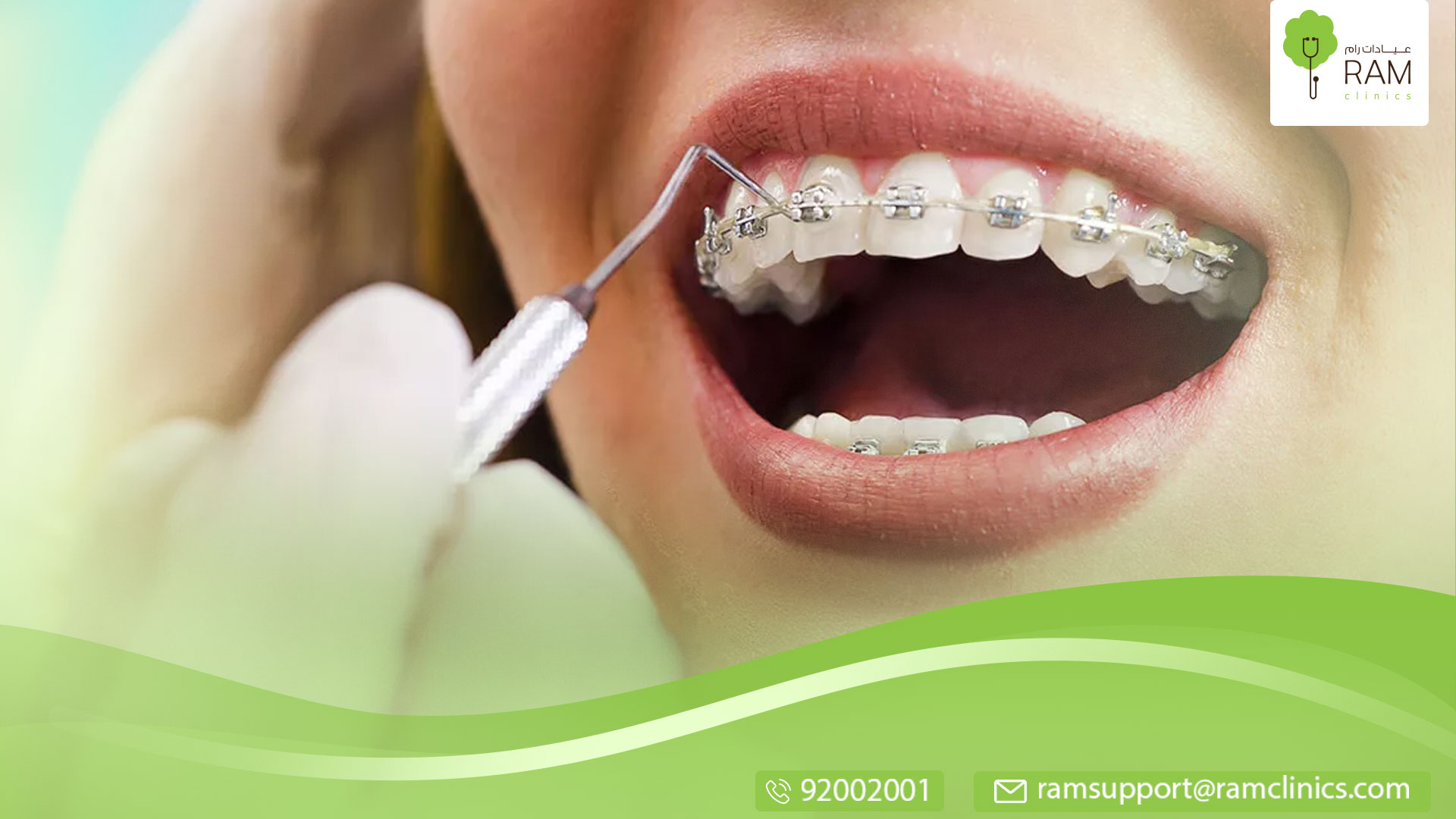 الدعامات السنية وتقويم الأسنان