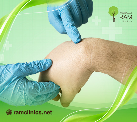 علاج الورم الشحمي