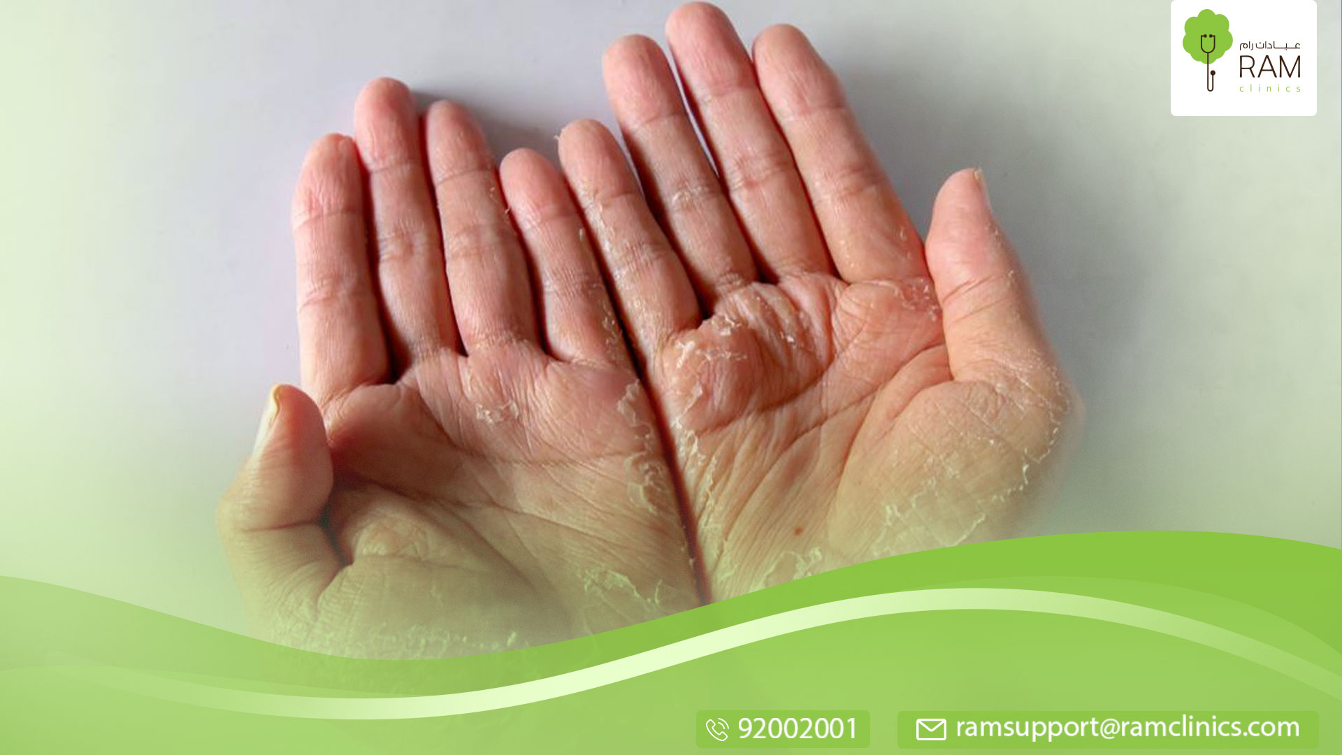 أسباب تقشّر الجلد وأعراضه