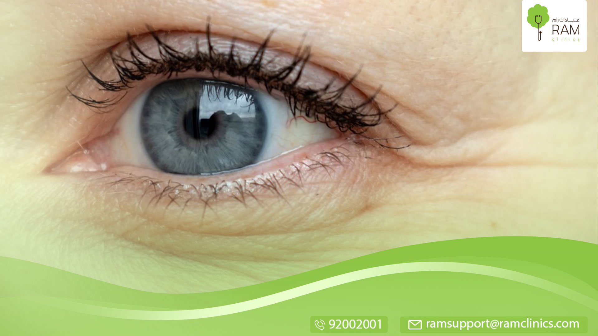 انسداد الغدد الدهنية في العين