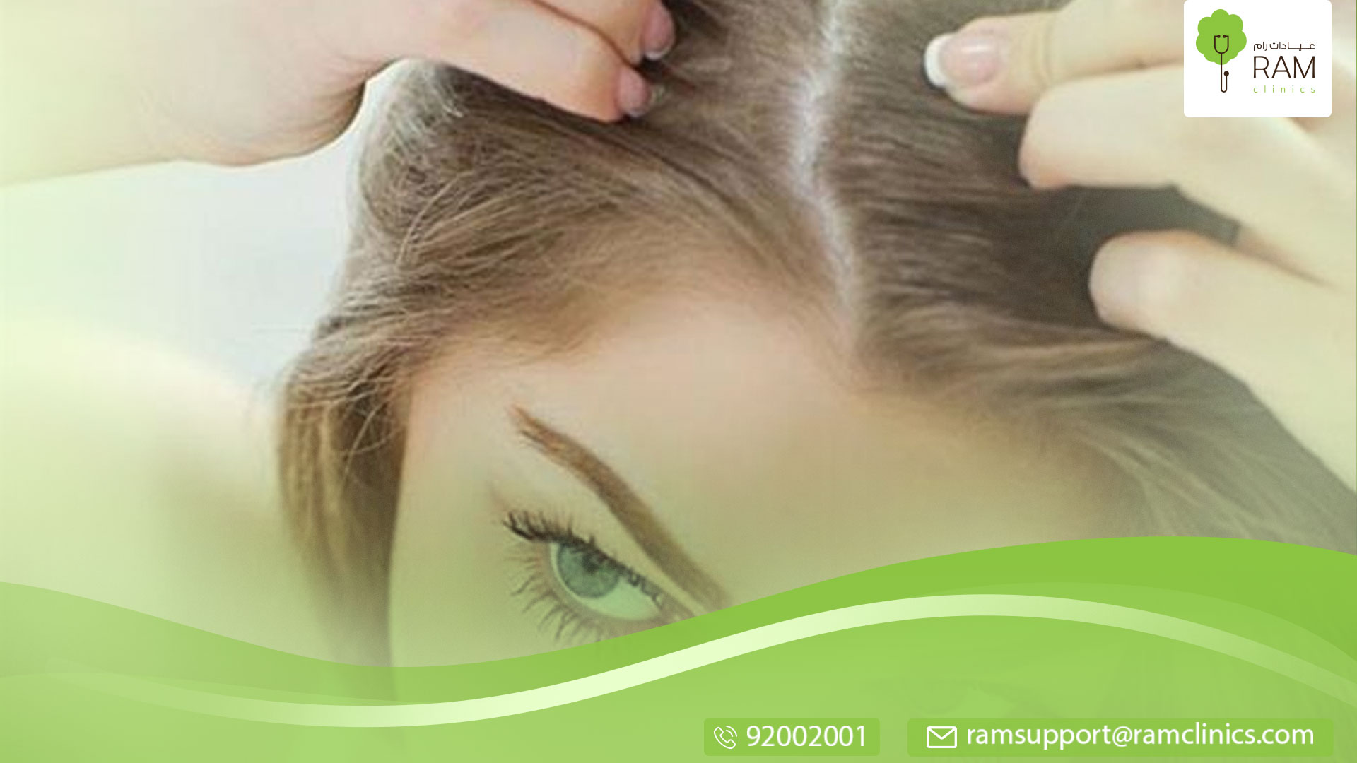 علاج قشرة الشعر