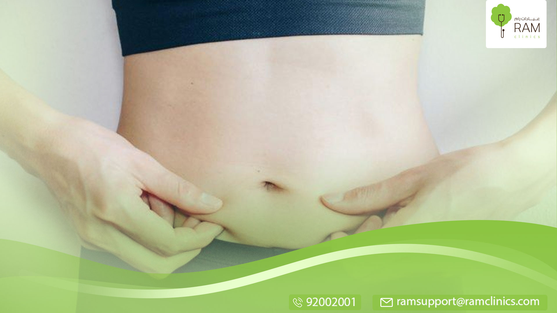 ترهلات البطن بعد الولادة