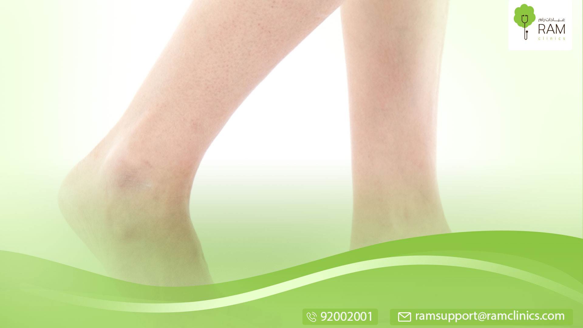 علاج البقع البيضاء على الساق