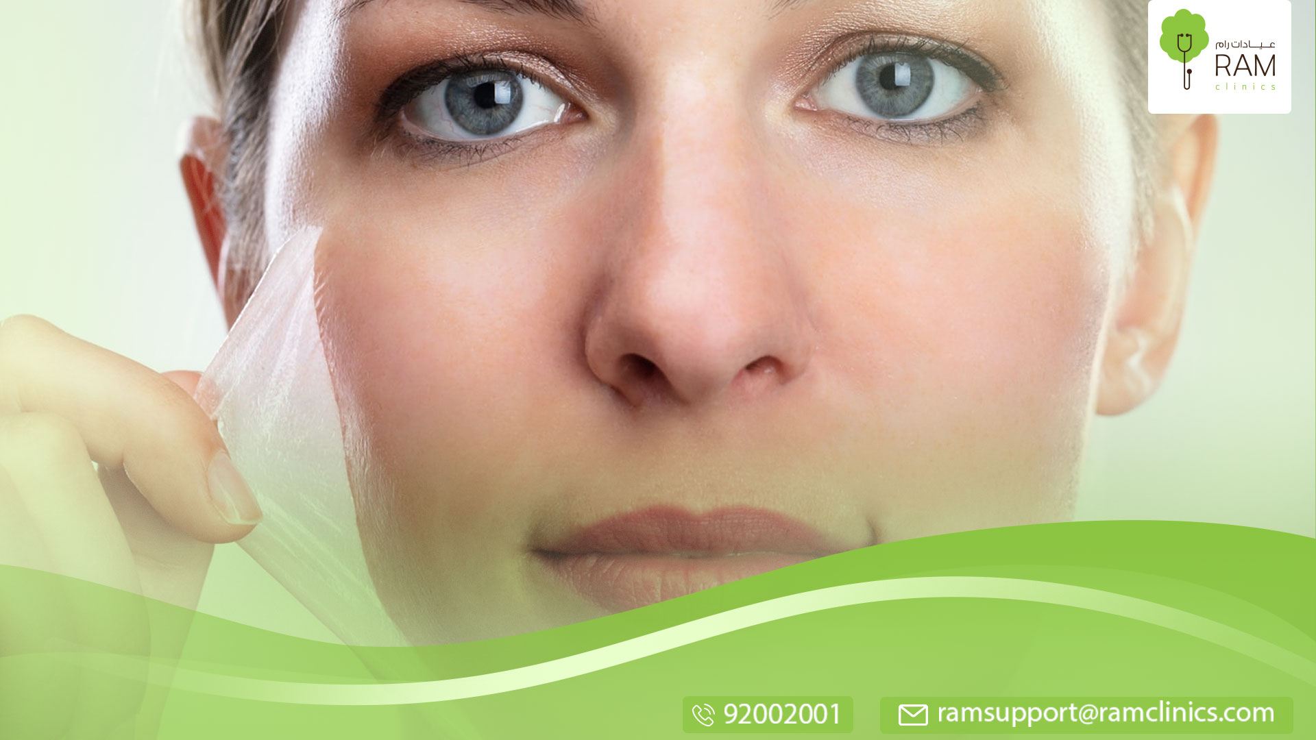 التقشير الكيميائي