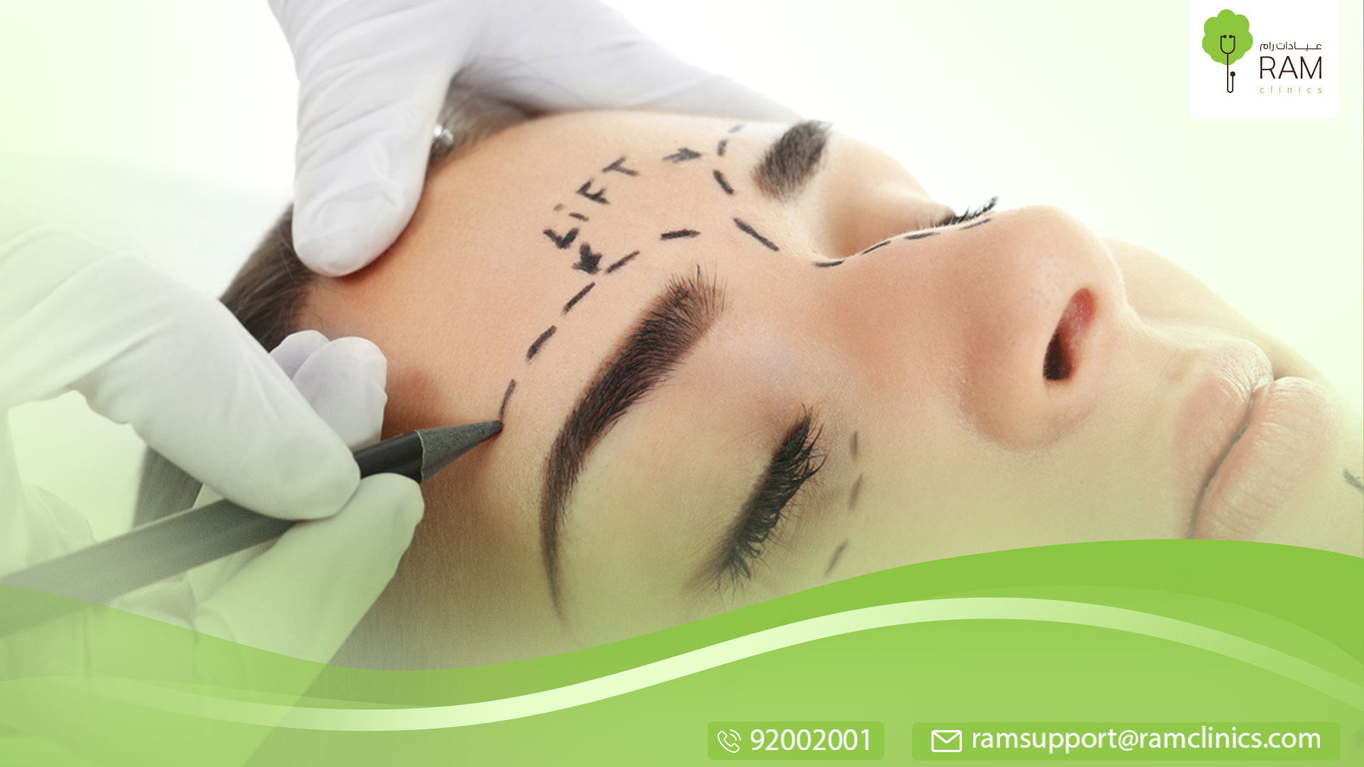 رفع الحواجب بالخيوط