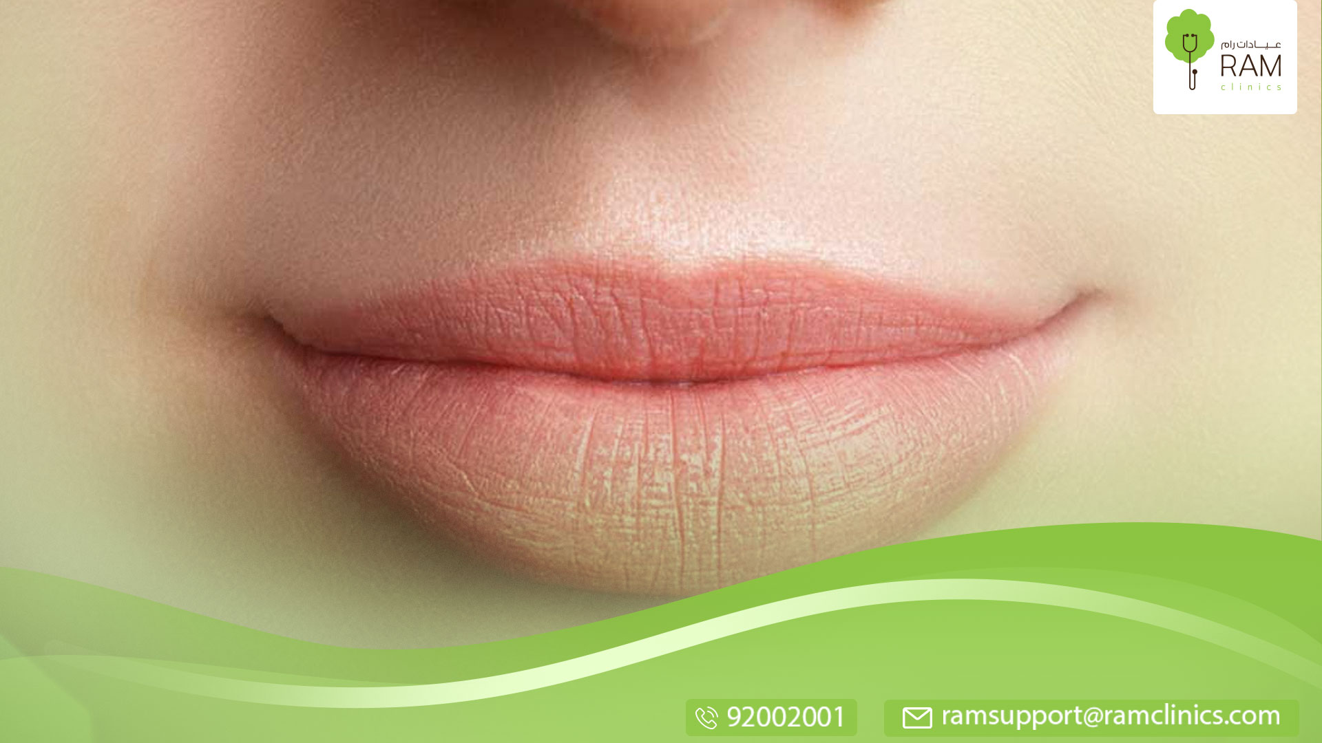 عملية تصغير الشفاه