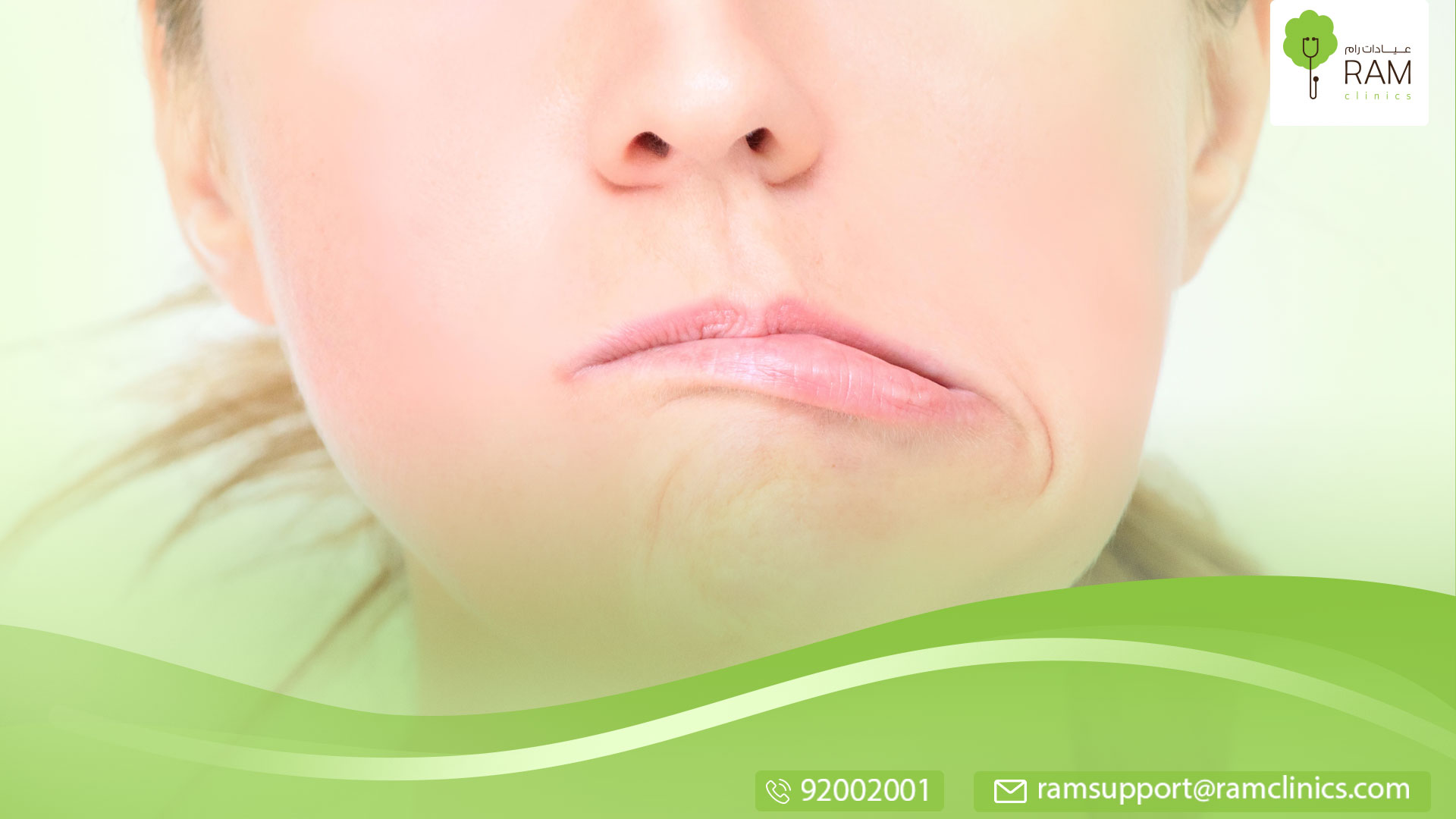 كم مدة علاج العصب السابع