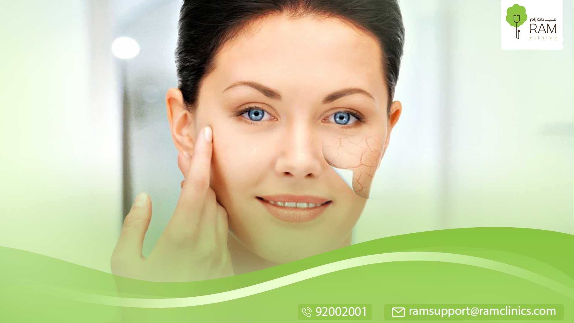 تصبغات الجلد