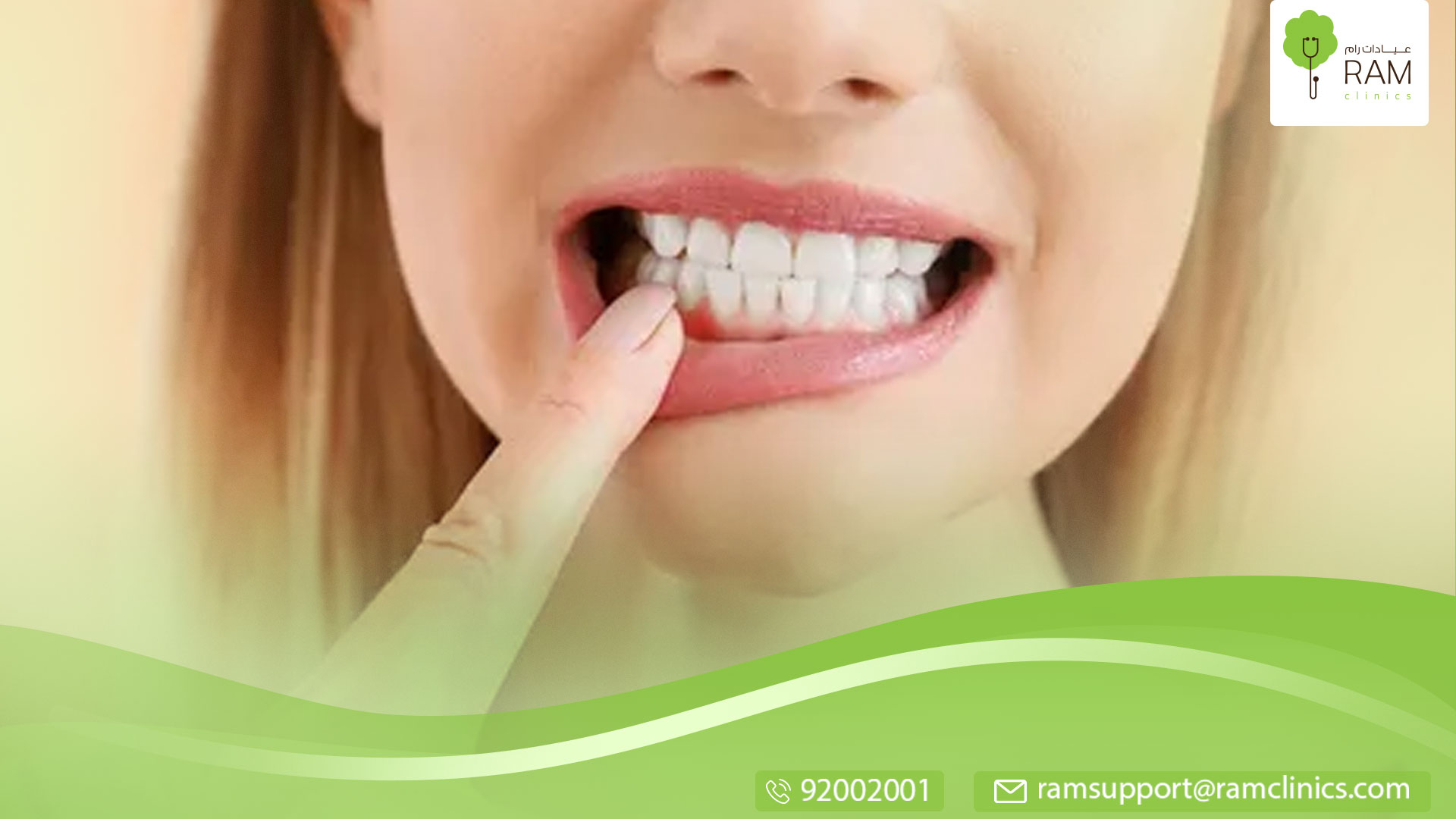 أسباب نزيف اللثة عند غسيل الأسنان