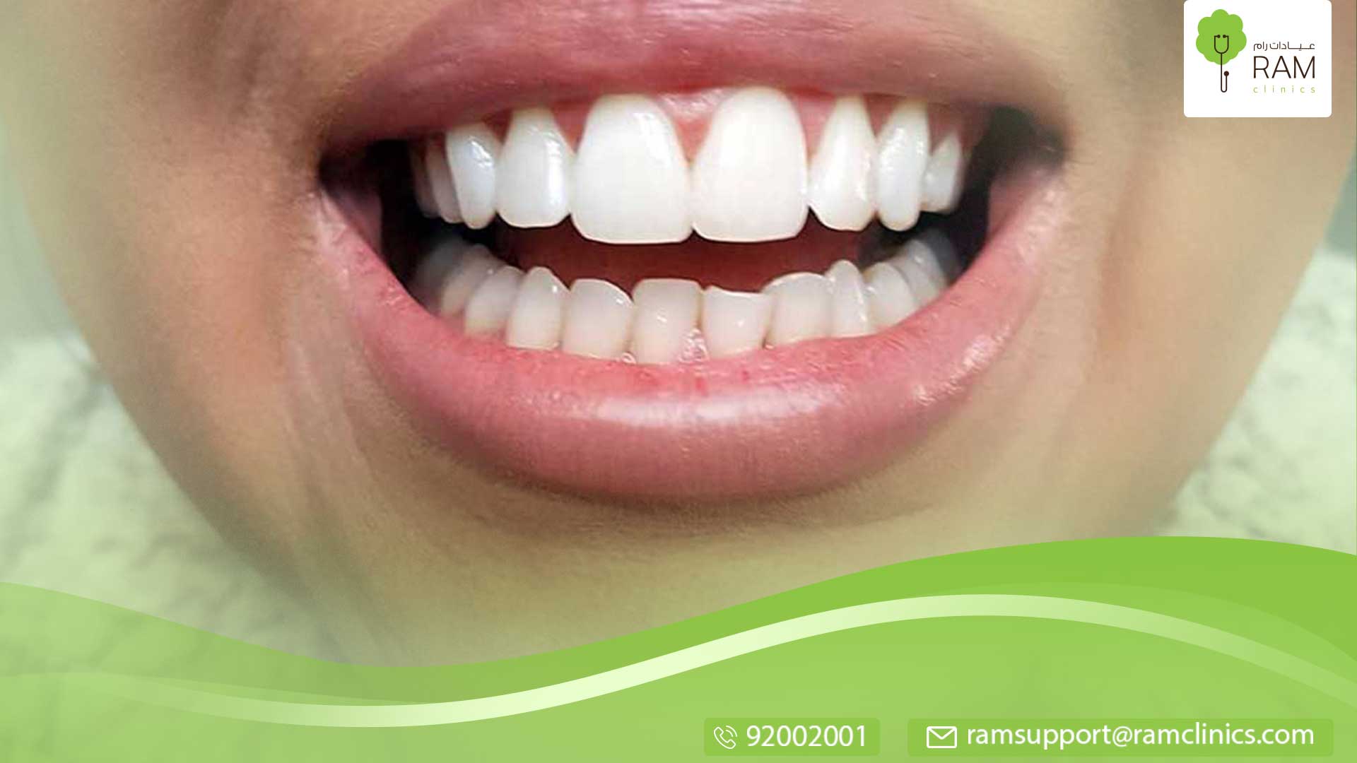 أضرار برد الأسنان