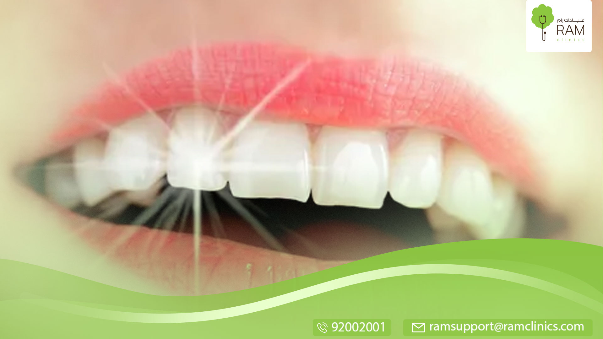 تبيض الاسنان باستخدام الليزر