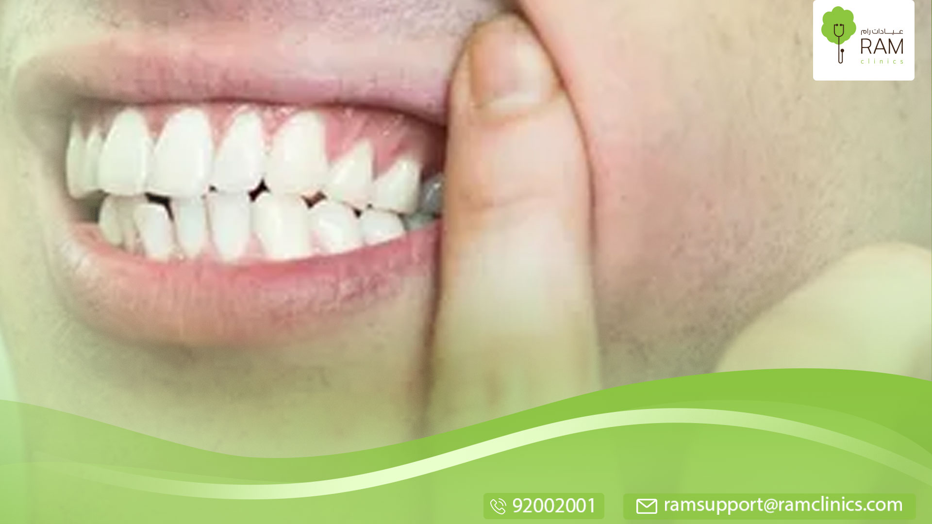 التهاب في اللثة