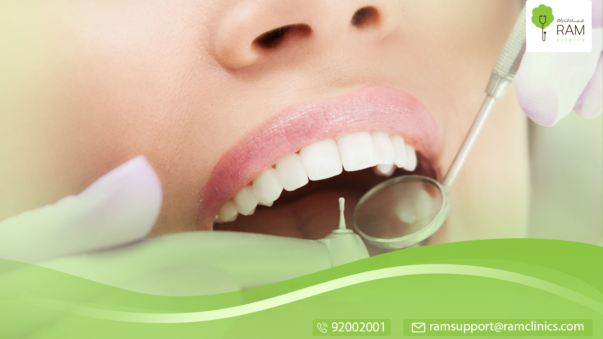 قلع الاسنان معلومات هامة