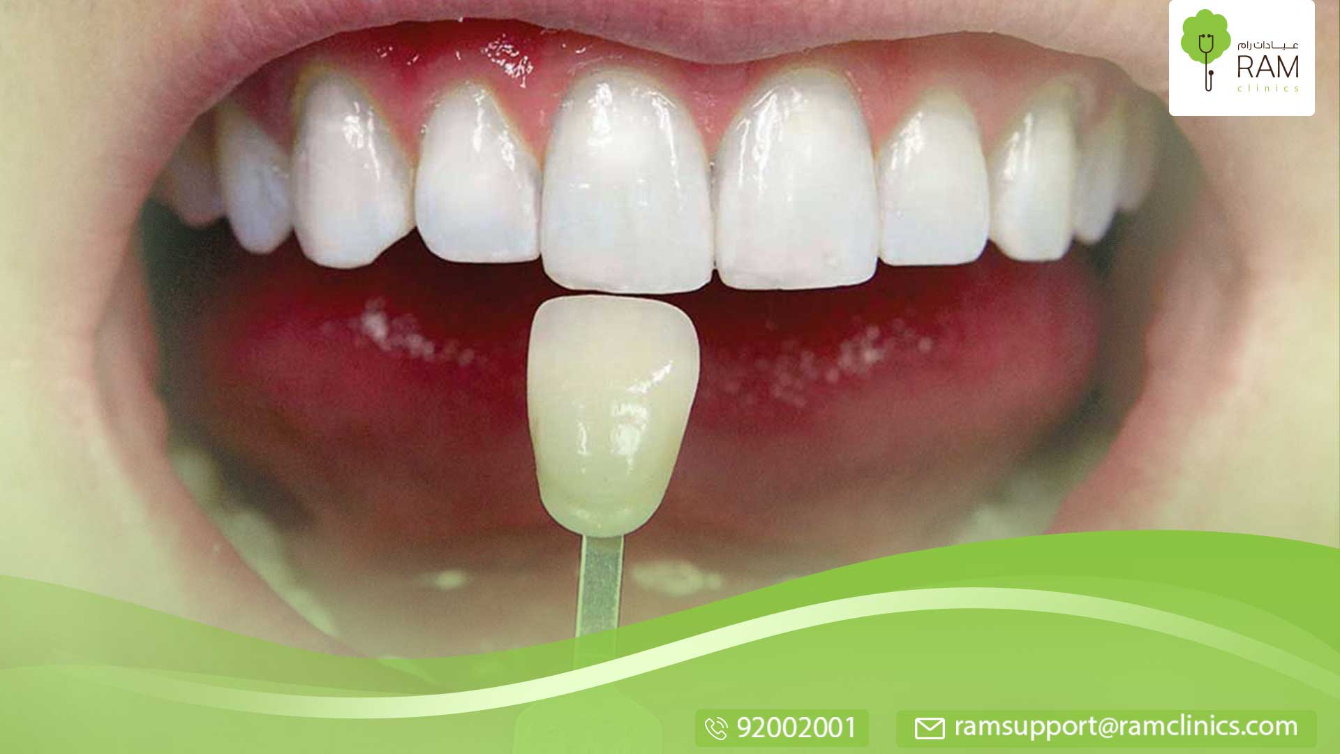 طرق منزلية للتخلص من اصفرار الاسنان