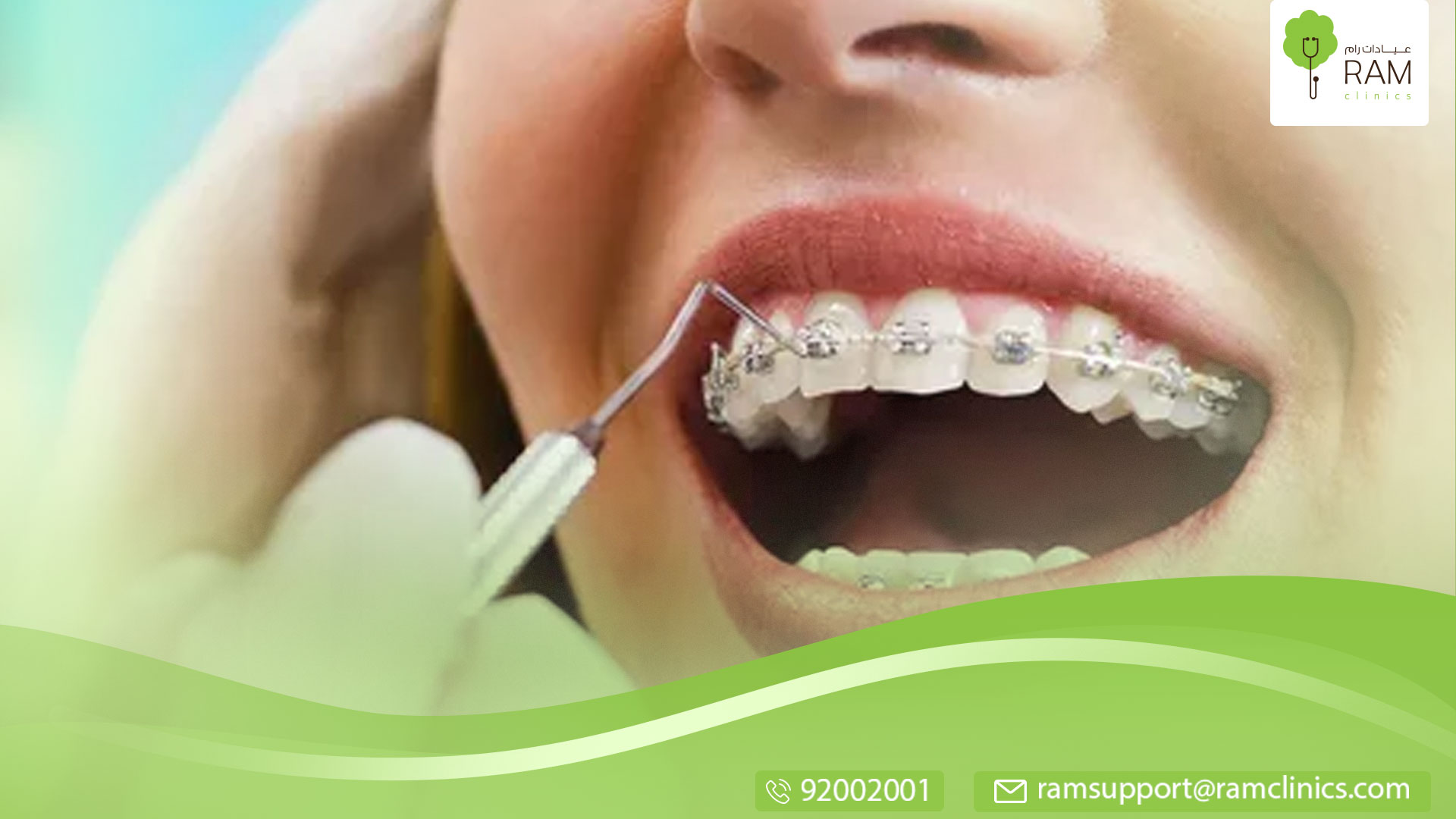 تقويم الأسنان عند الأطفال