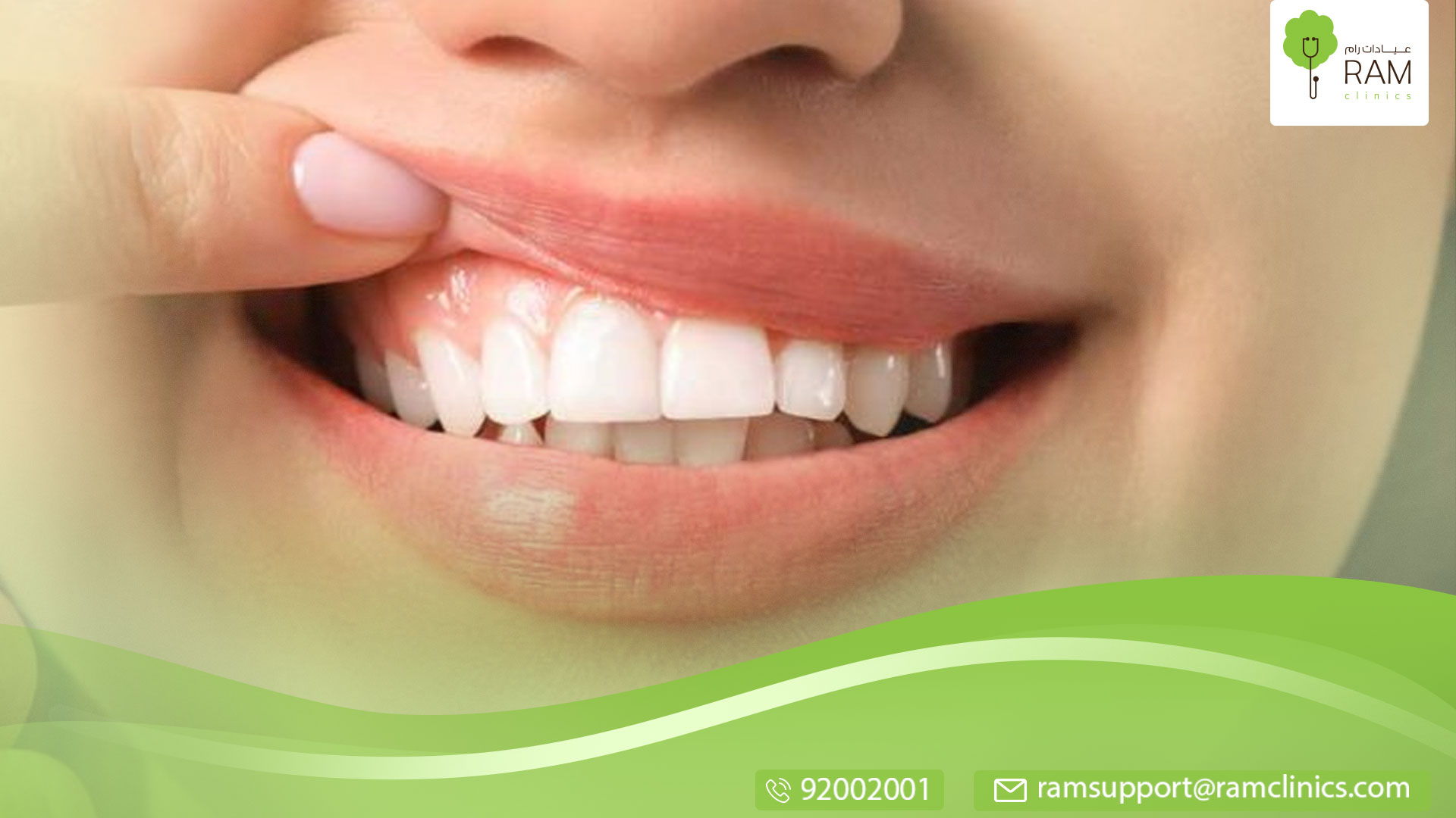 علاج التهاب اللثة سريعا