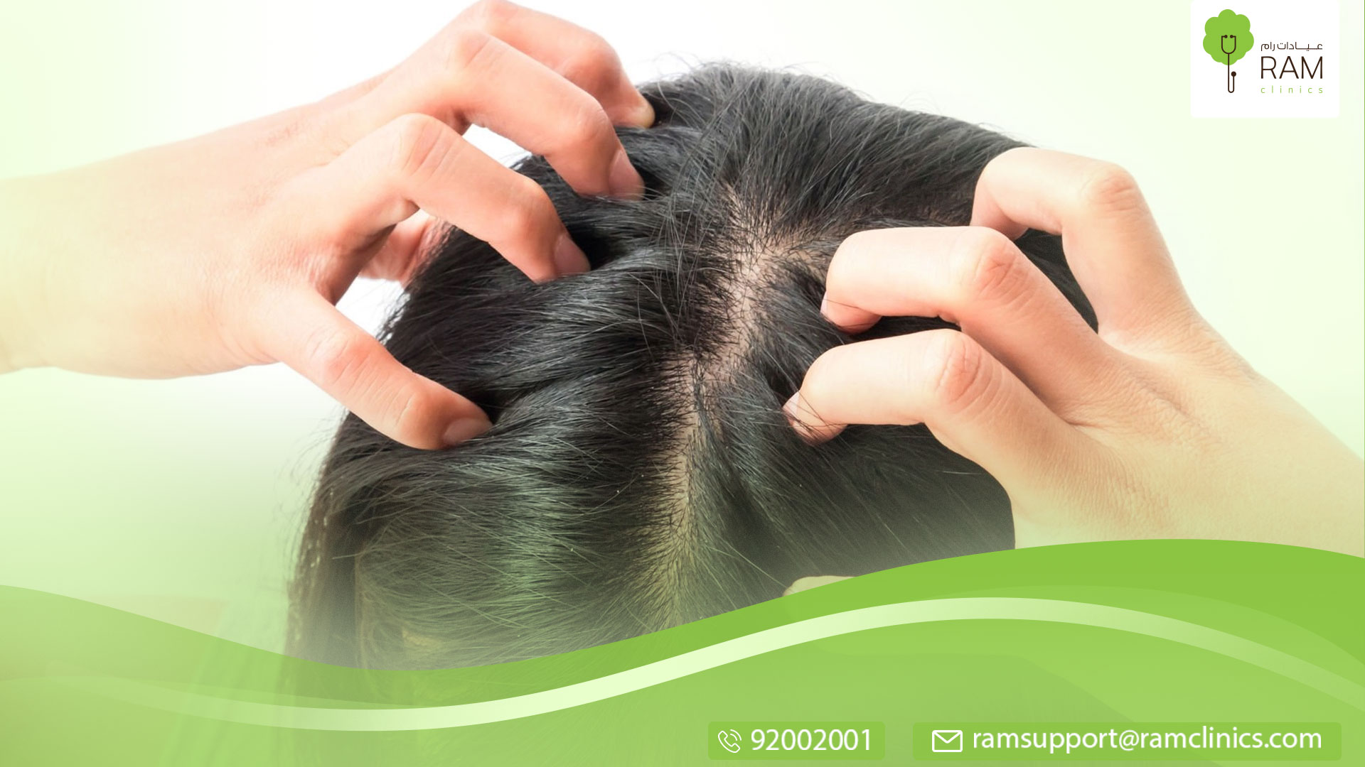 و‏فطريات فروة الرأس