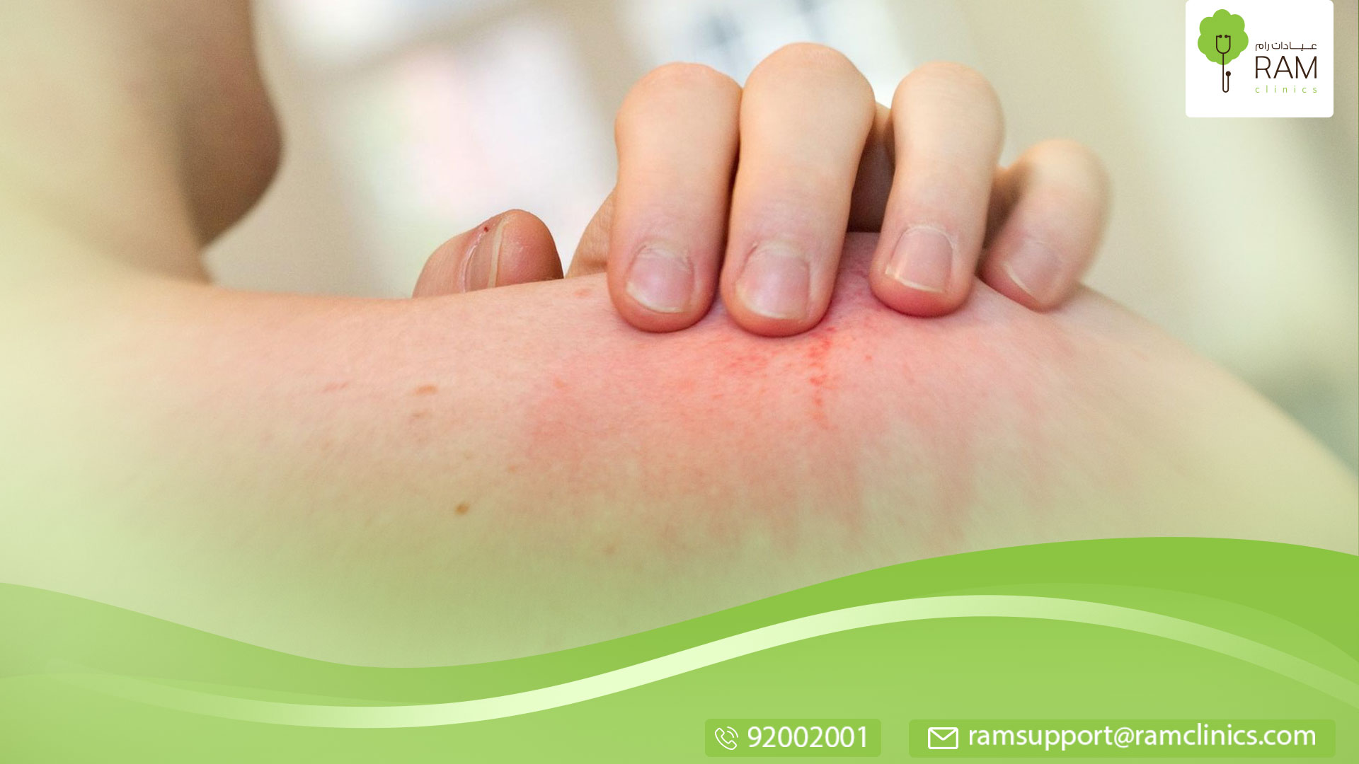 فطريات الجلد الحمراء