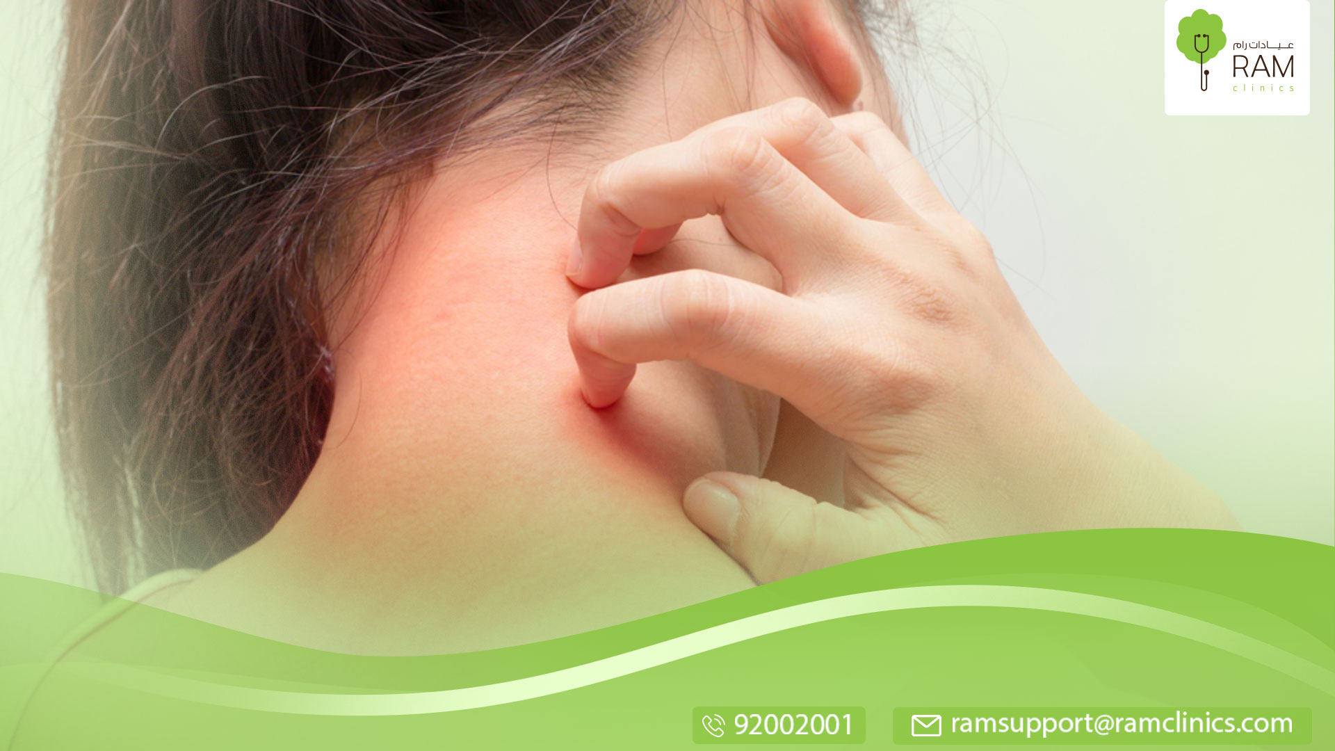 علاج الحزاز